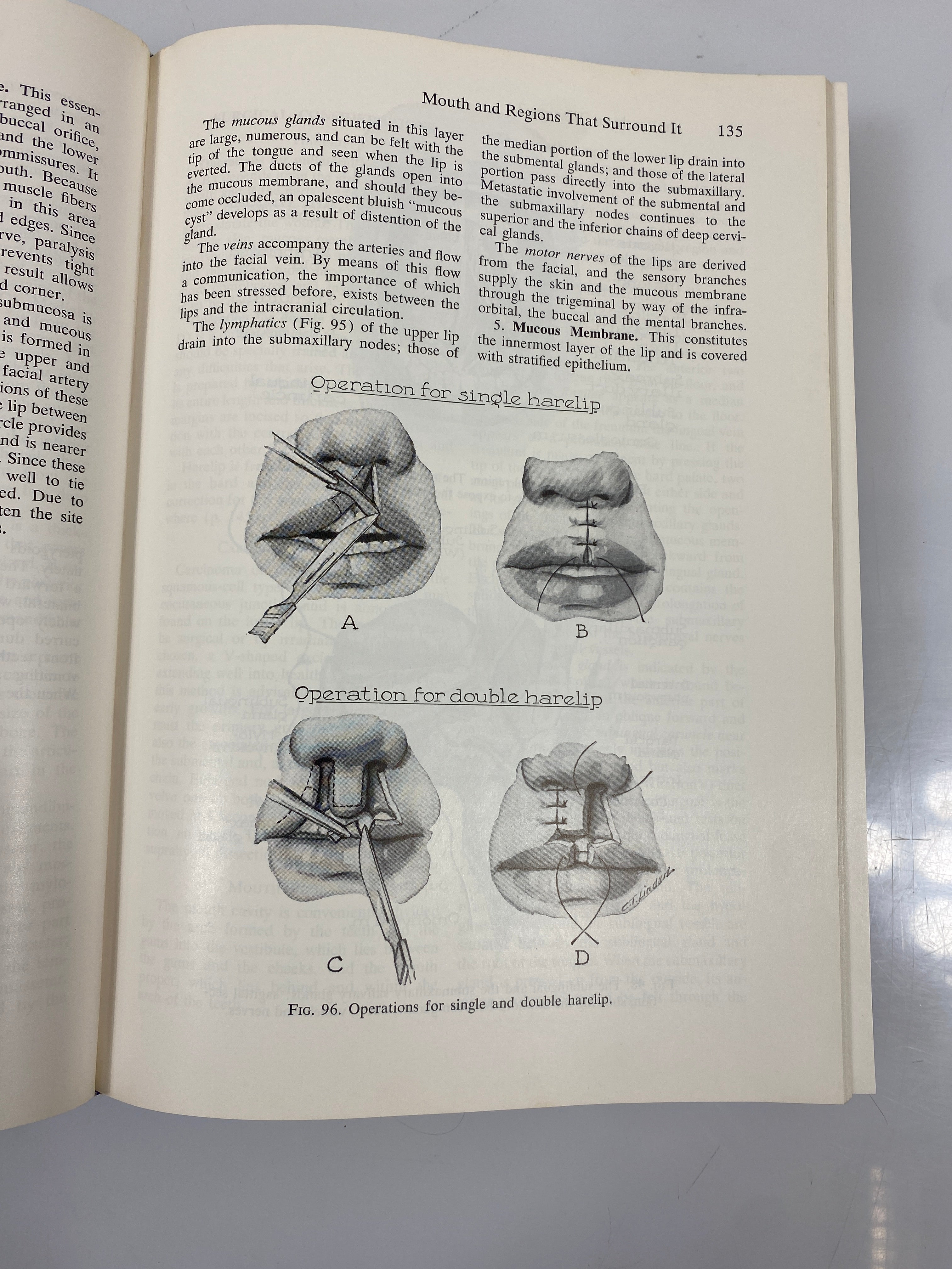 Anatomy in Surgery Philip Thorek J.B. Lippincott Company 2nd Ed. 1962 HC