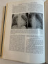 2 Vintage Medical Texts: Heart Disease-Congenital/Infancy & Childhood 1959-67