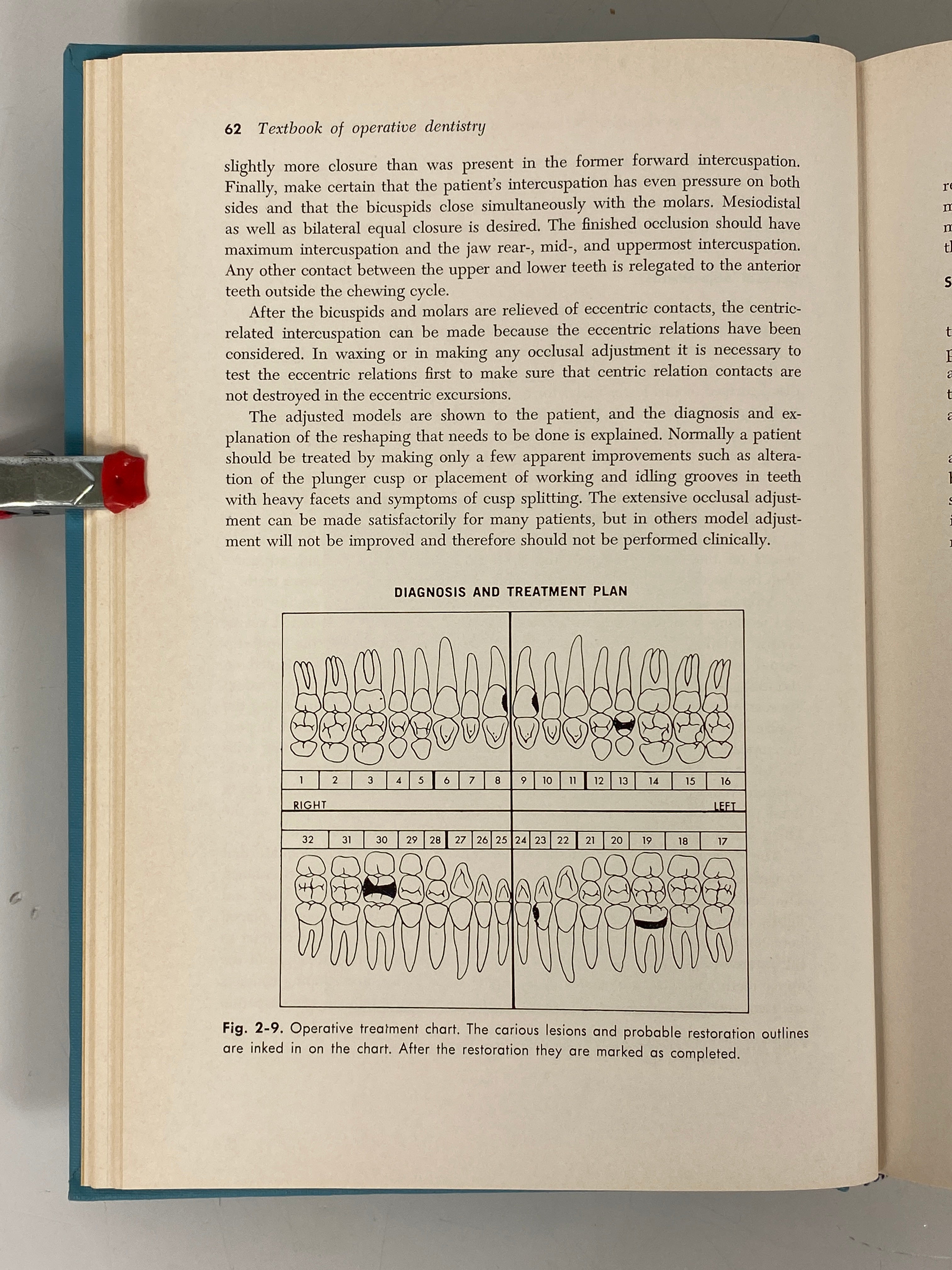 2 Vols: Textbook of Operative Dentistry/Textbook of Oral Surgery 1967-68 HC