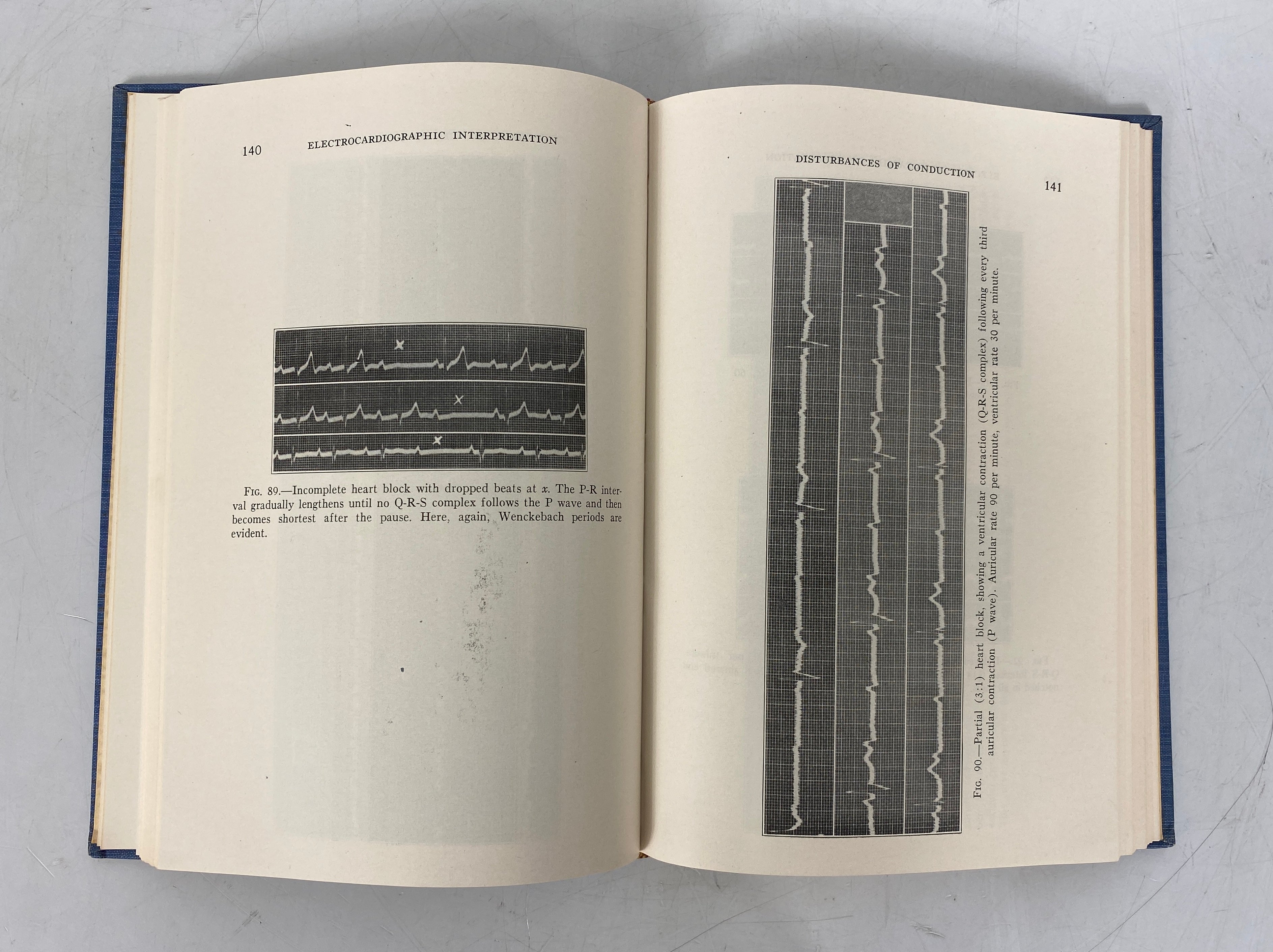 2 Volumes: Rapid Interpretation of EKG's/Fundamentals of EKG Interpretation