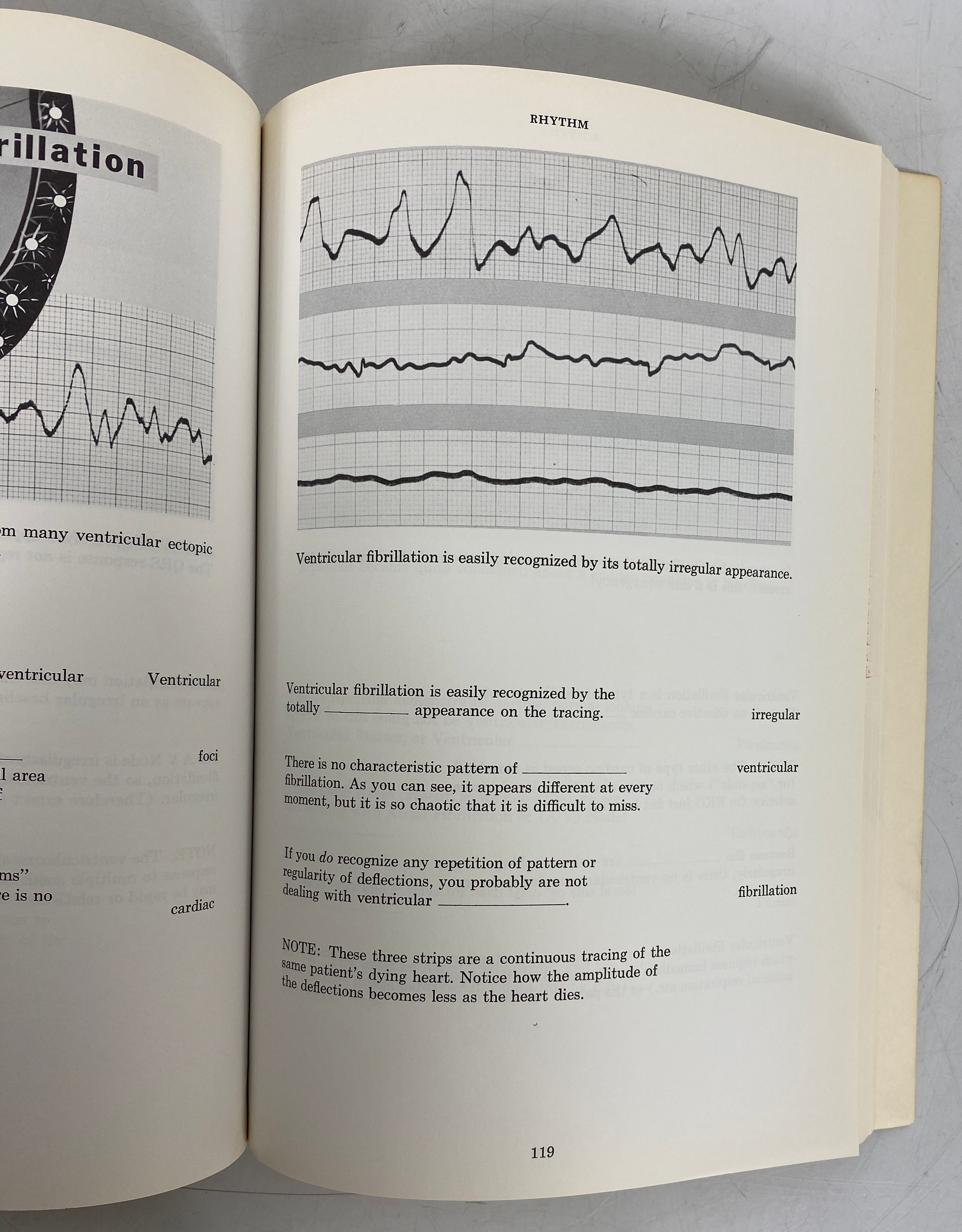 2 Volumes: Rapid Interpretation of EKG's/Fundamentals of EKG Interpretation