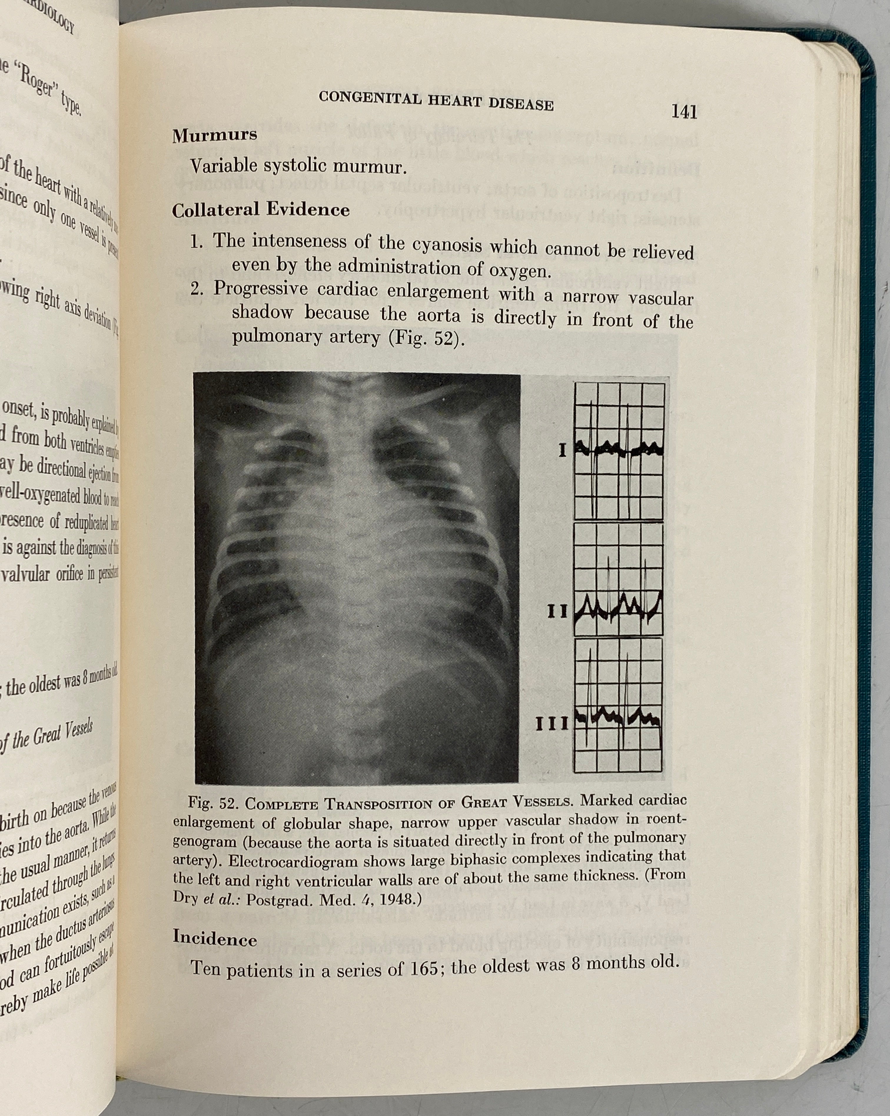 A Manual of Cardiology by Thomas Dry 1950 Second Edition SC