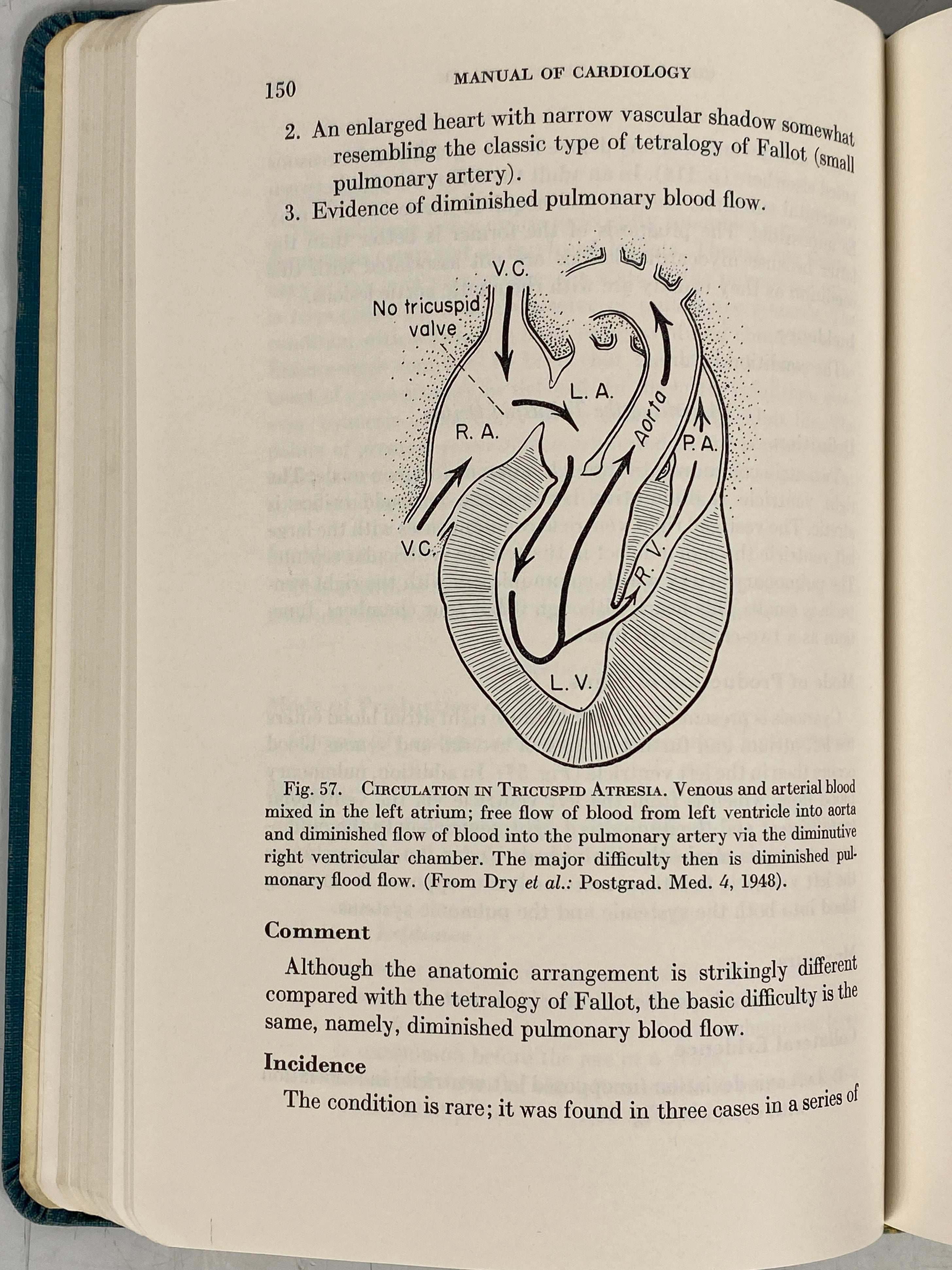 A Manual of Cardiology by Thomas Dry 1950 Second Edition SC