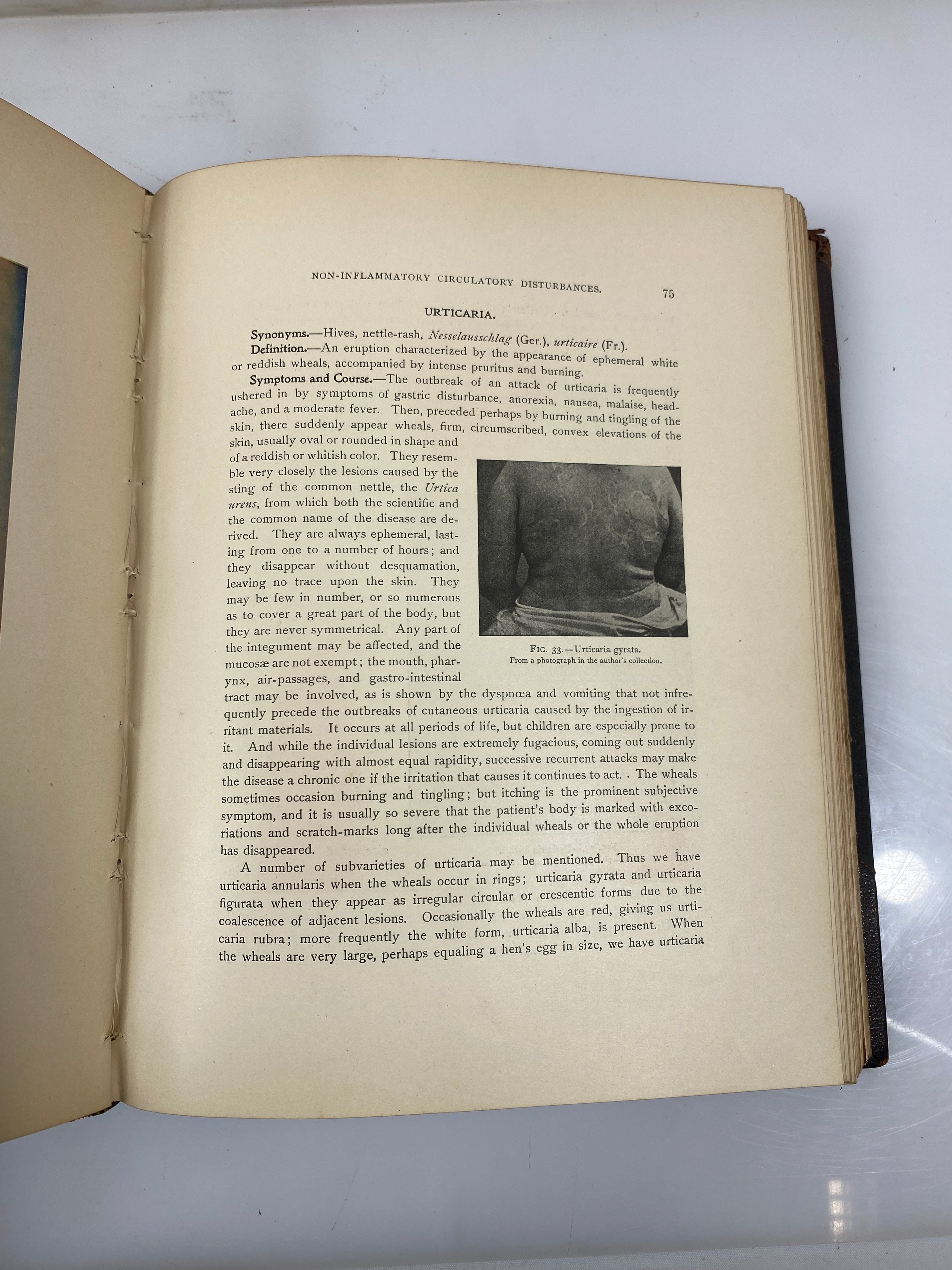 Illustrated Skin Diseases: An Atlas and Text-Book by Gottheil 1899 HC