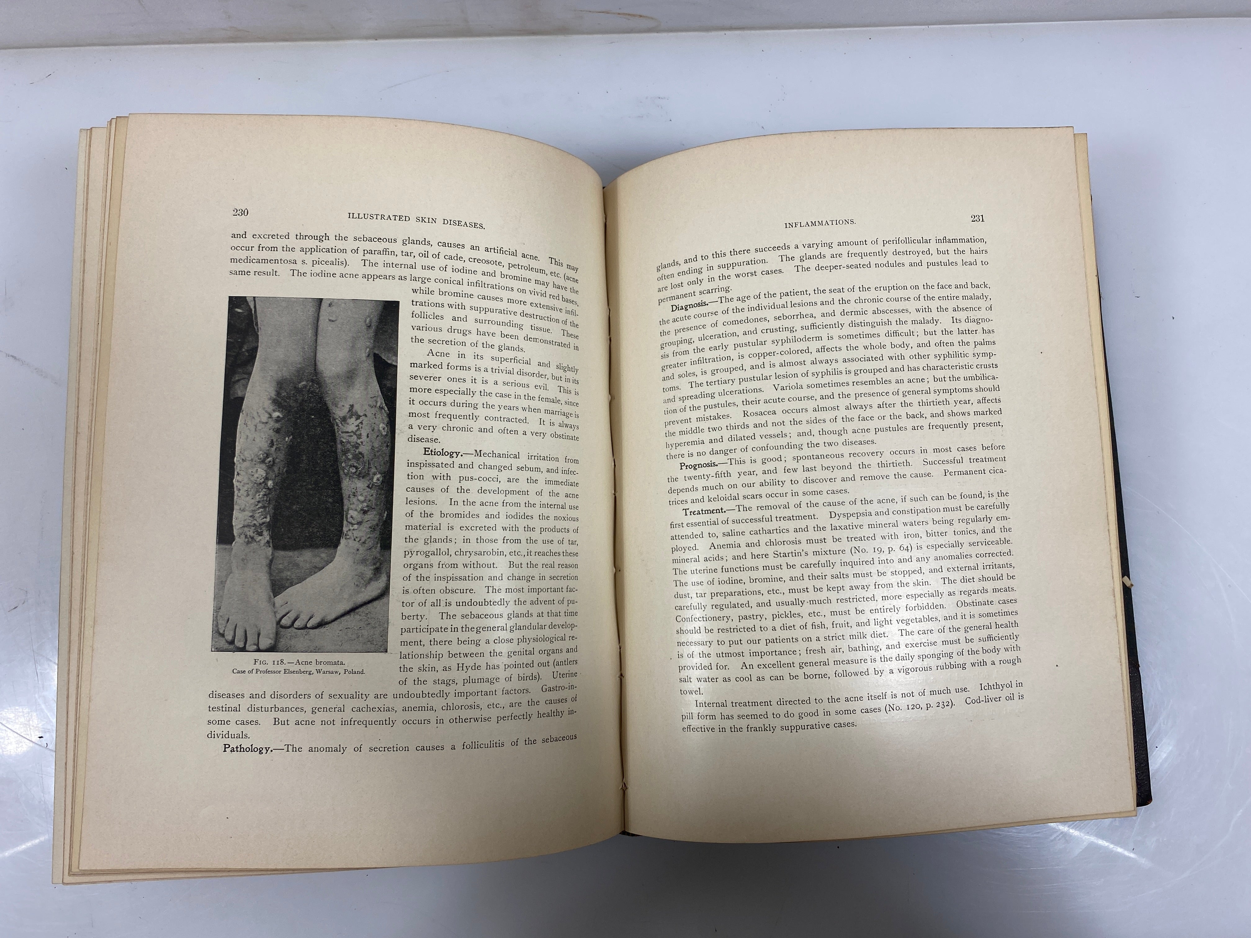 Illustrated Skin Diseases: An Atlas and Text-Book by Gottheil 1899 HC