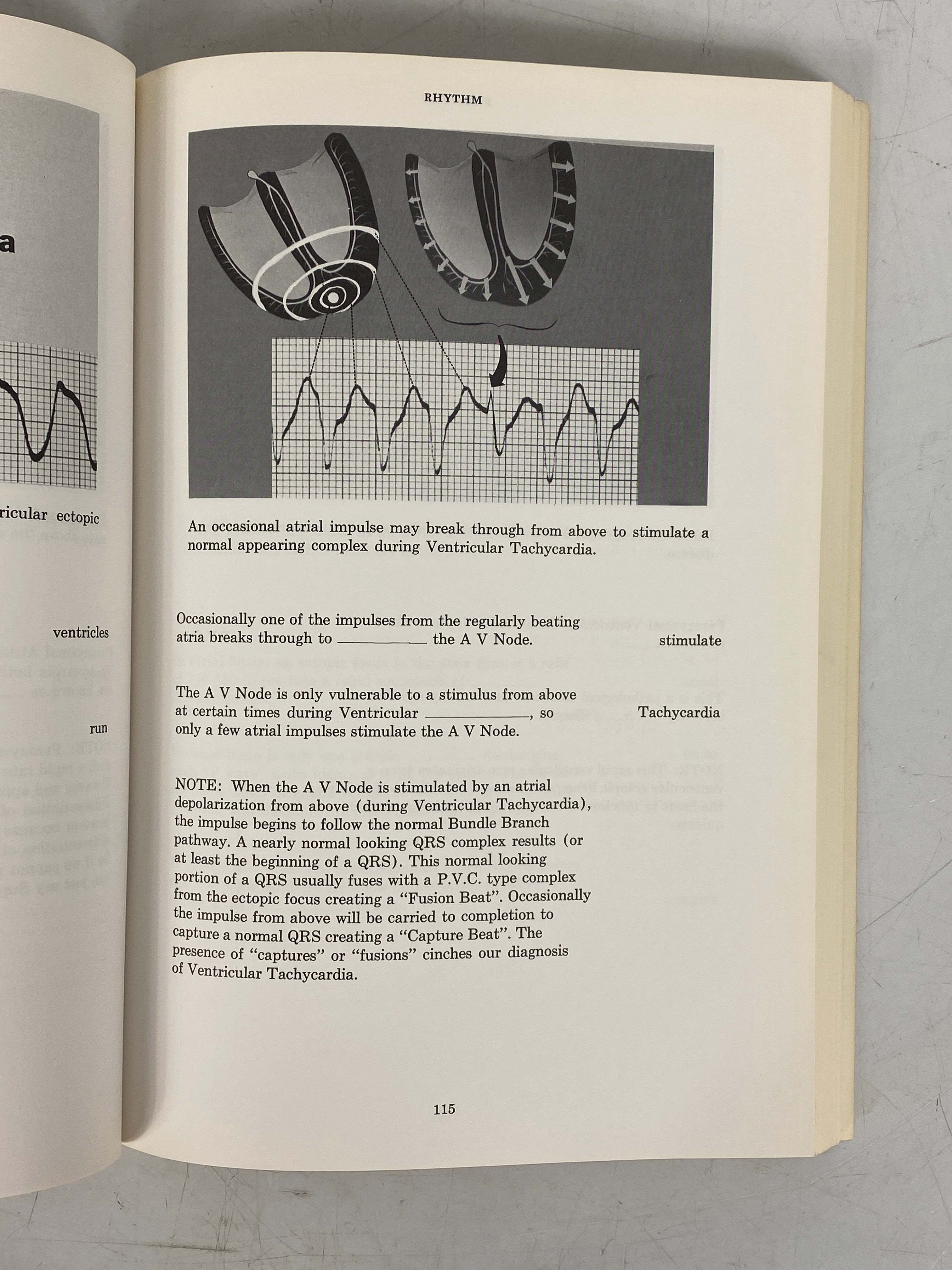 Rapid Interpretation of EKG's by Dale Dubin 1974 Third Edition SC