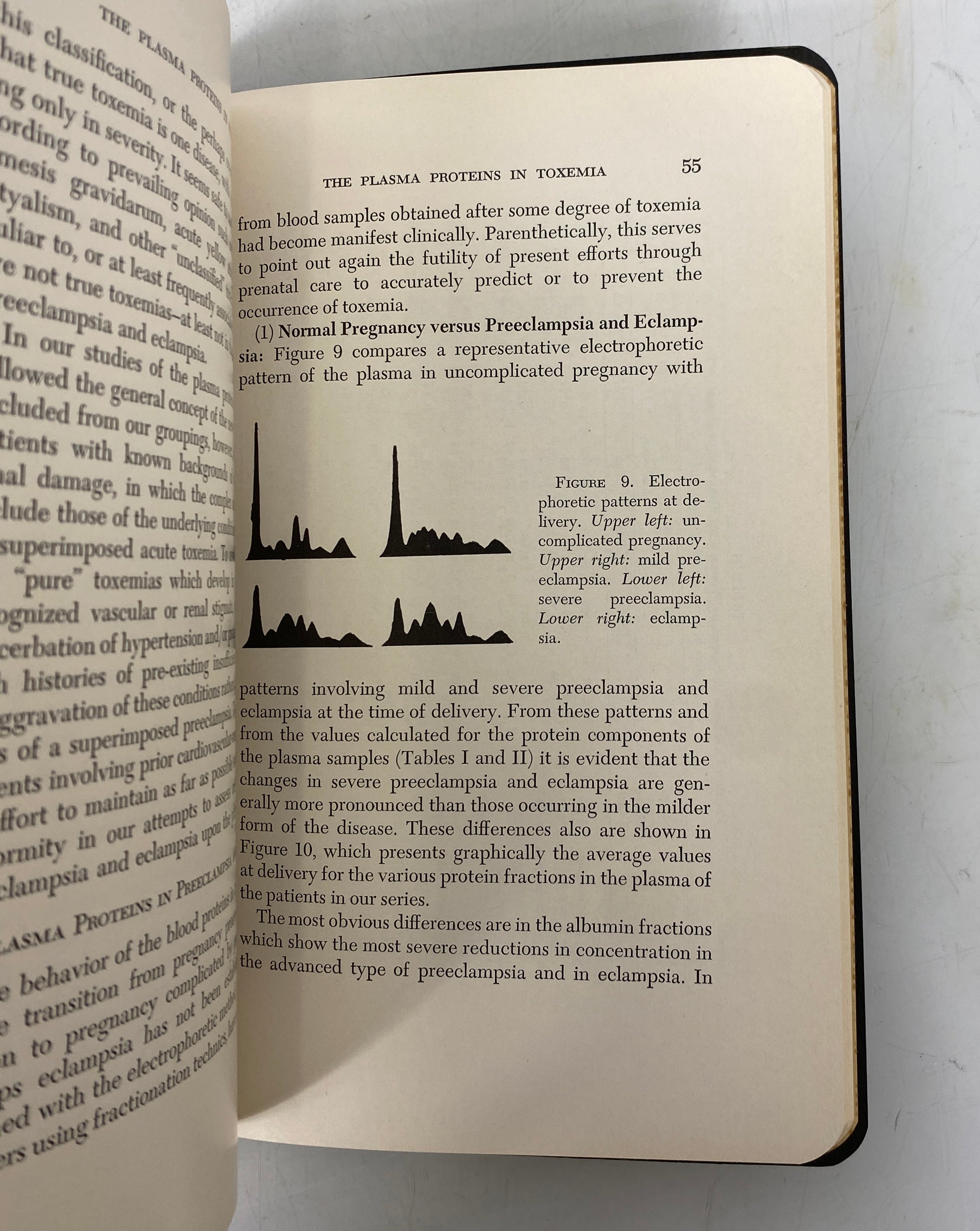 5 Vtg American Lecture Series incl Normal/Abnormal Labor/Iliac Pain/Amenorrhea