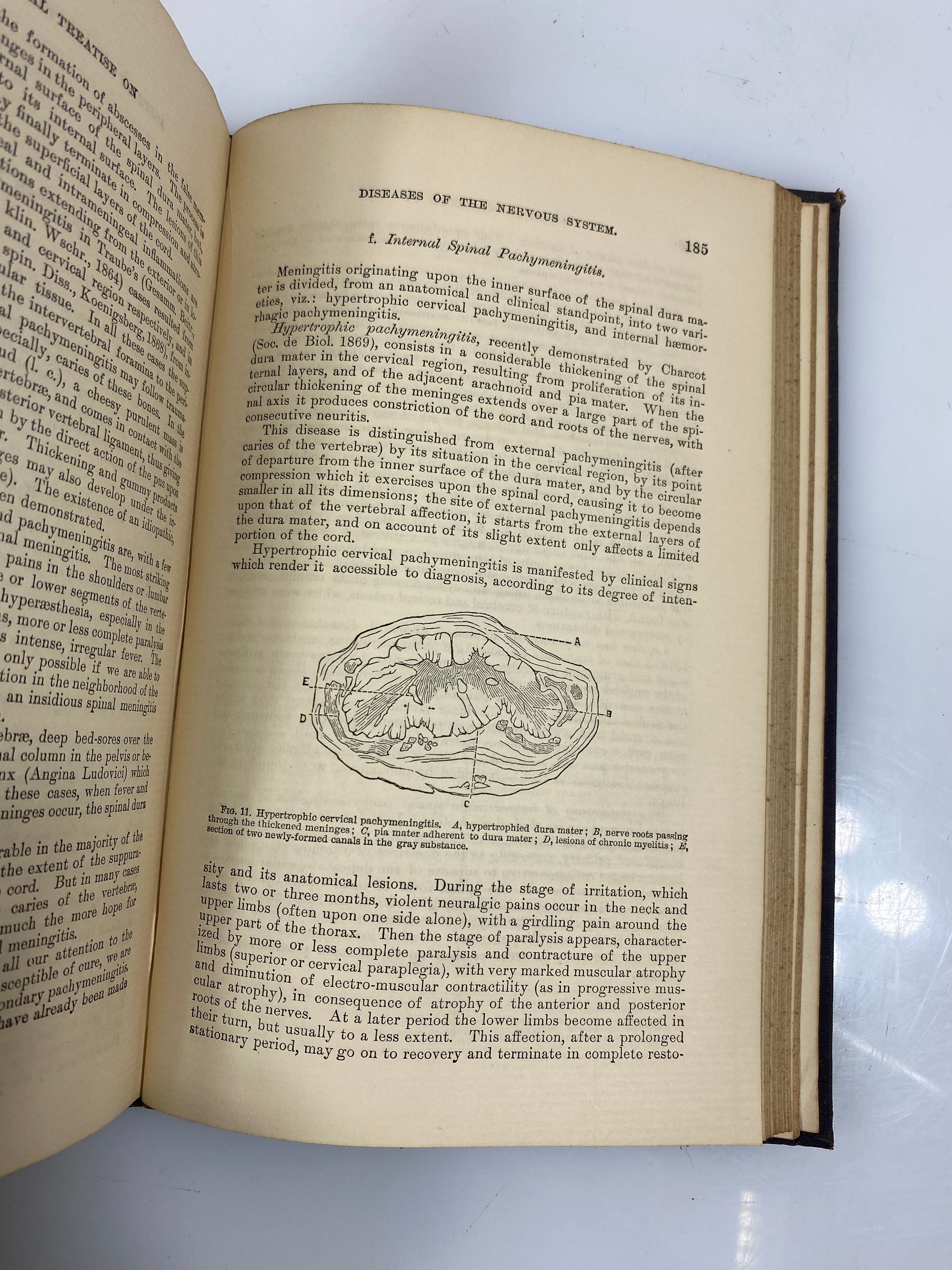 Clinical Treatise on the Diseases of the Nervous System Rosenthal Vol. I 1879 HC