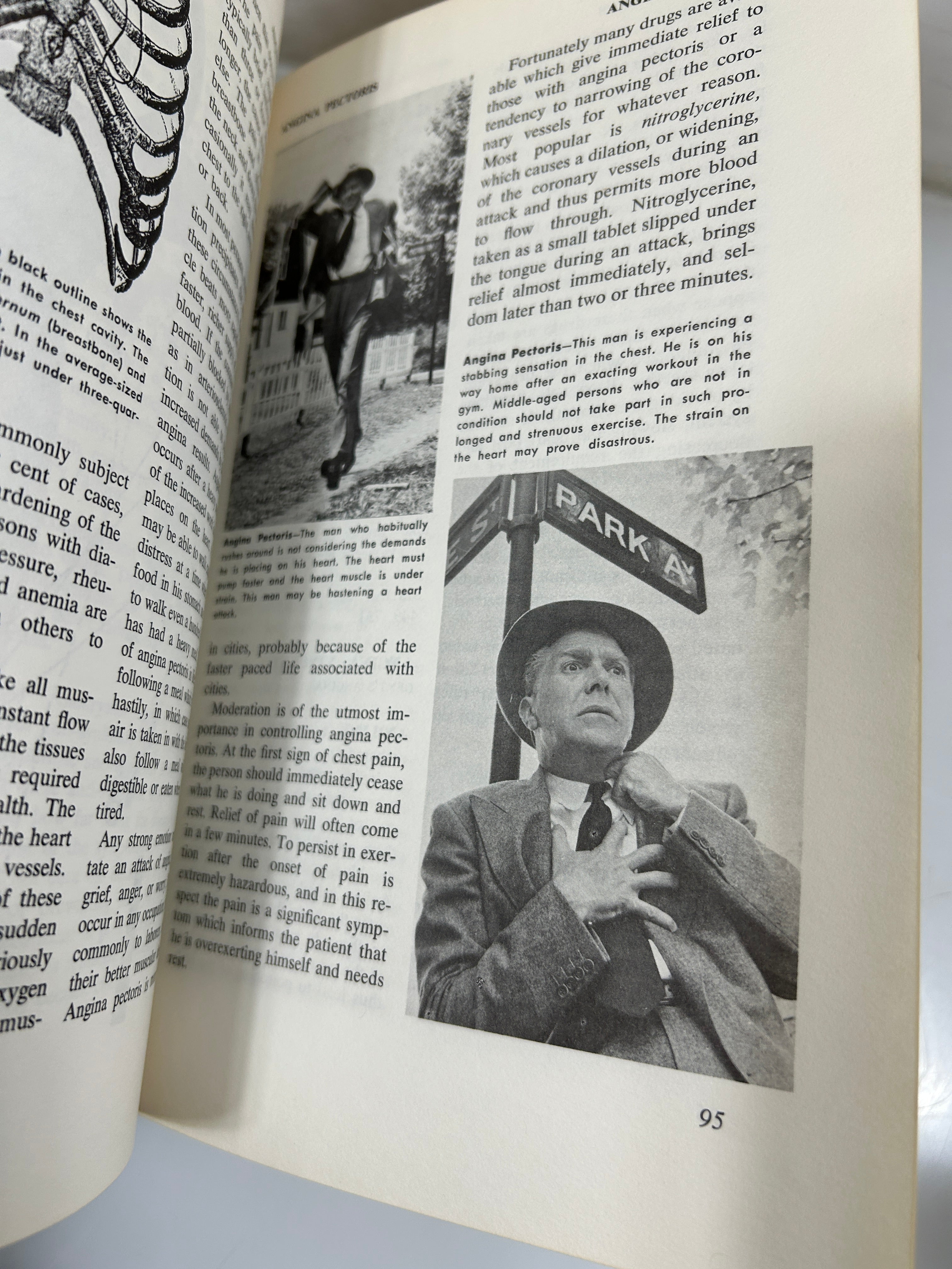 Set of 4 The New Illustrated Medical & Health Encyclopedia Ed Fishbein 1975 HC