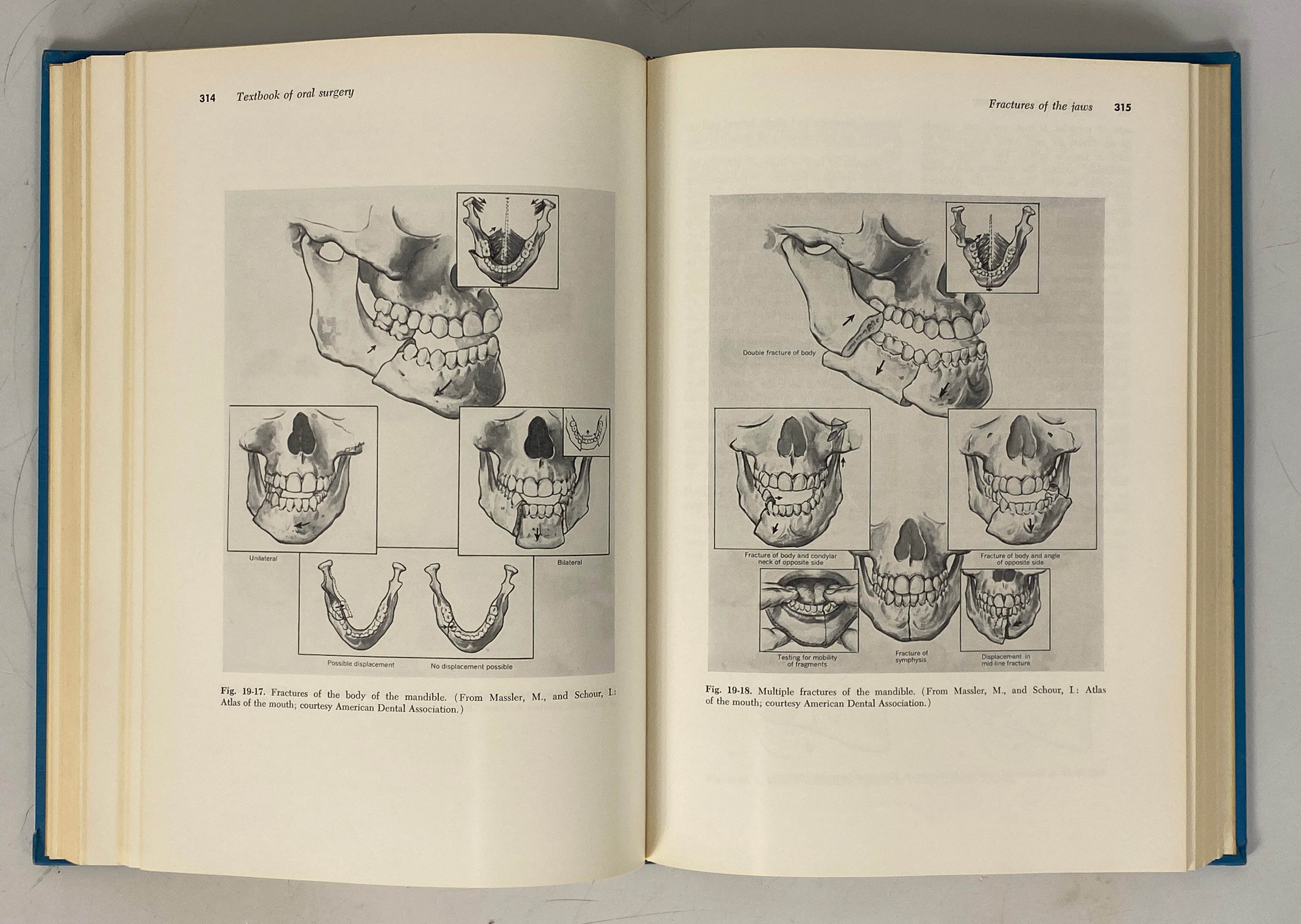 2 Vols: Textbook of Operative Dentistry/Textbook of Oral Surgery 1967-68 HC