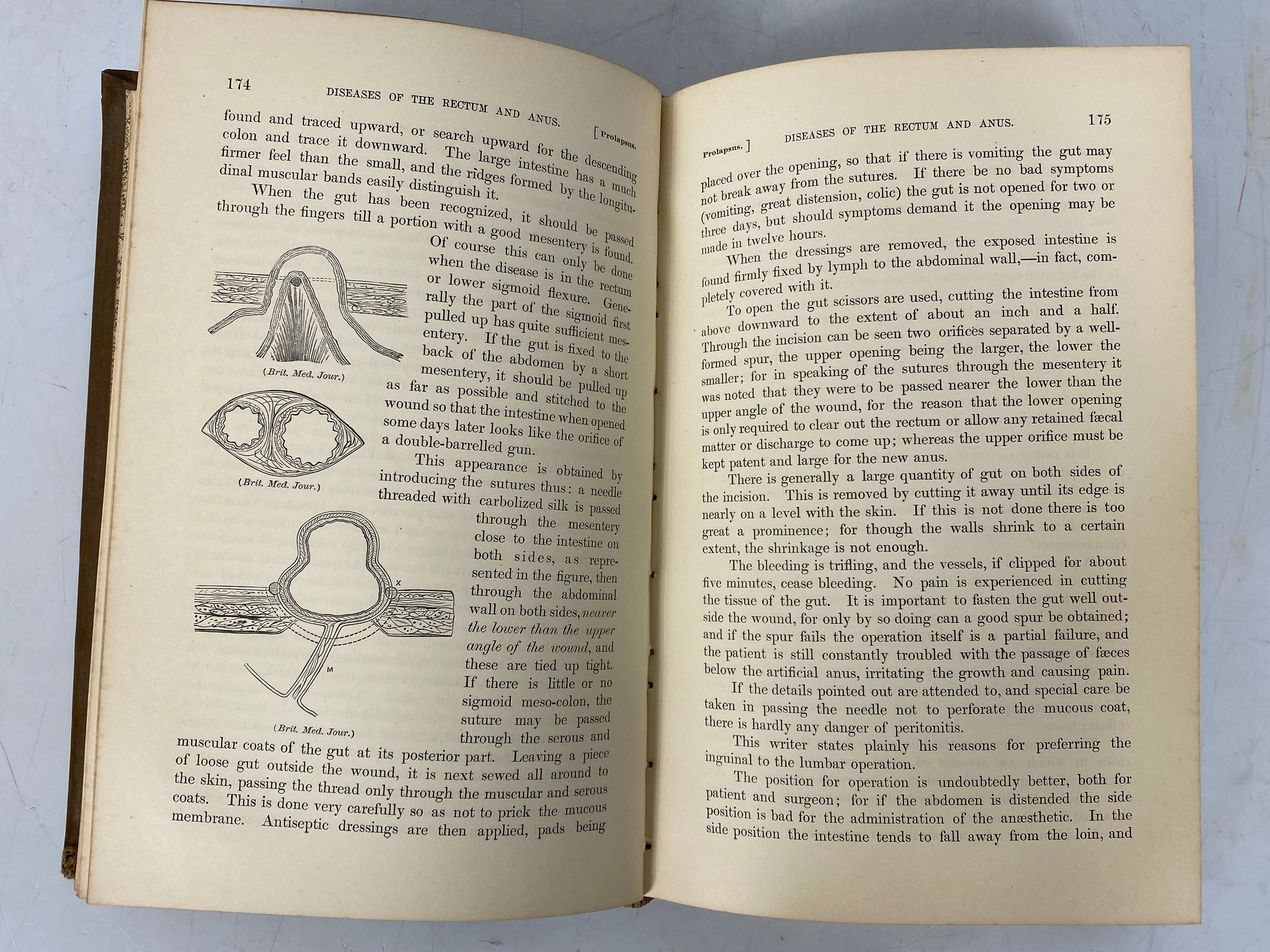 4 Vols Annual of the Universal Medical Sciences by Sajous 1888 (1-4) HC