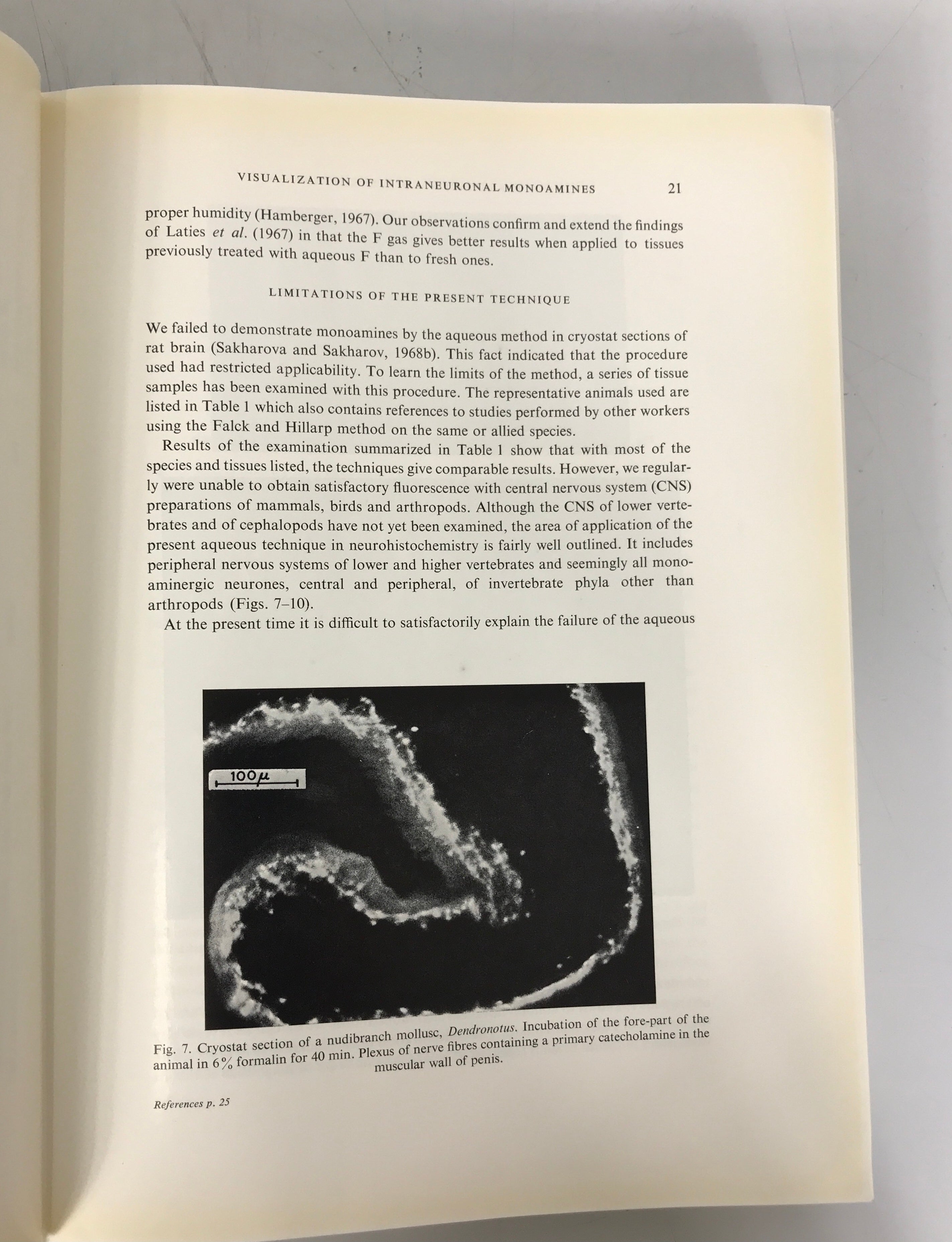 Progress in Brain Research 34 Histochemistry of Nervous Transmission 1971