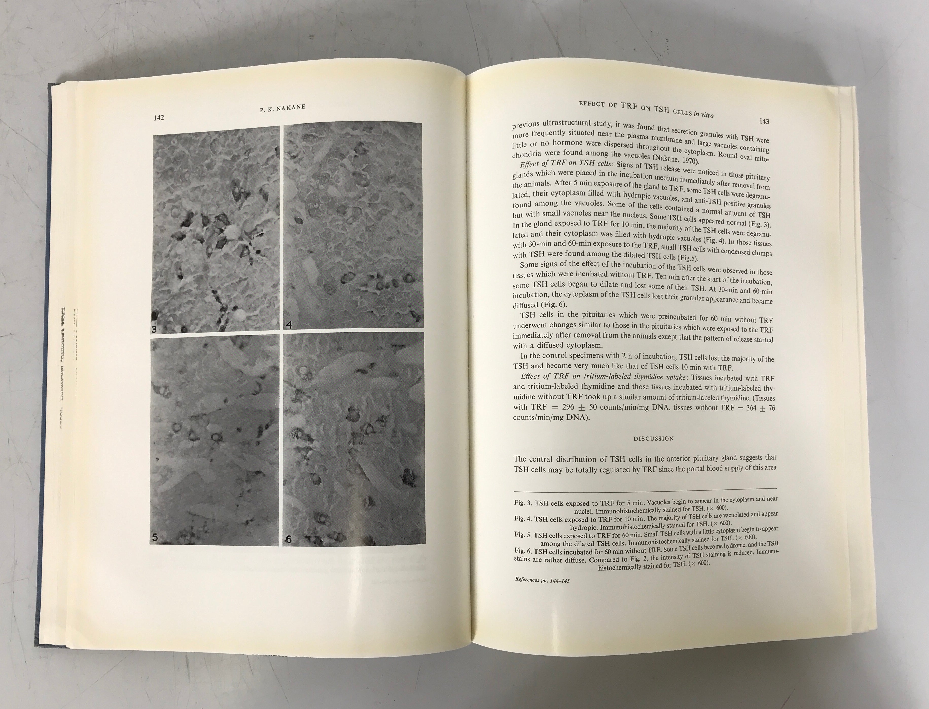 Progress in Brain Research 34 Histochemistry of Nervous Transmission 1971