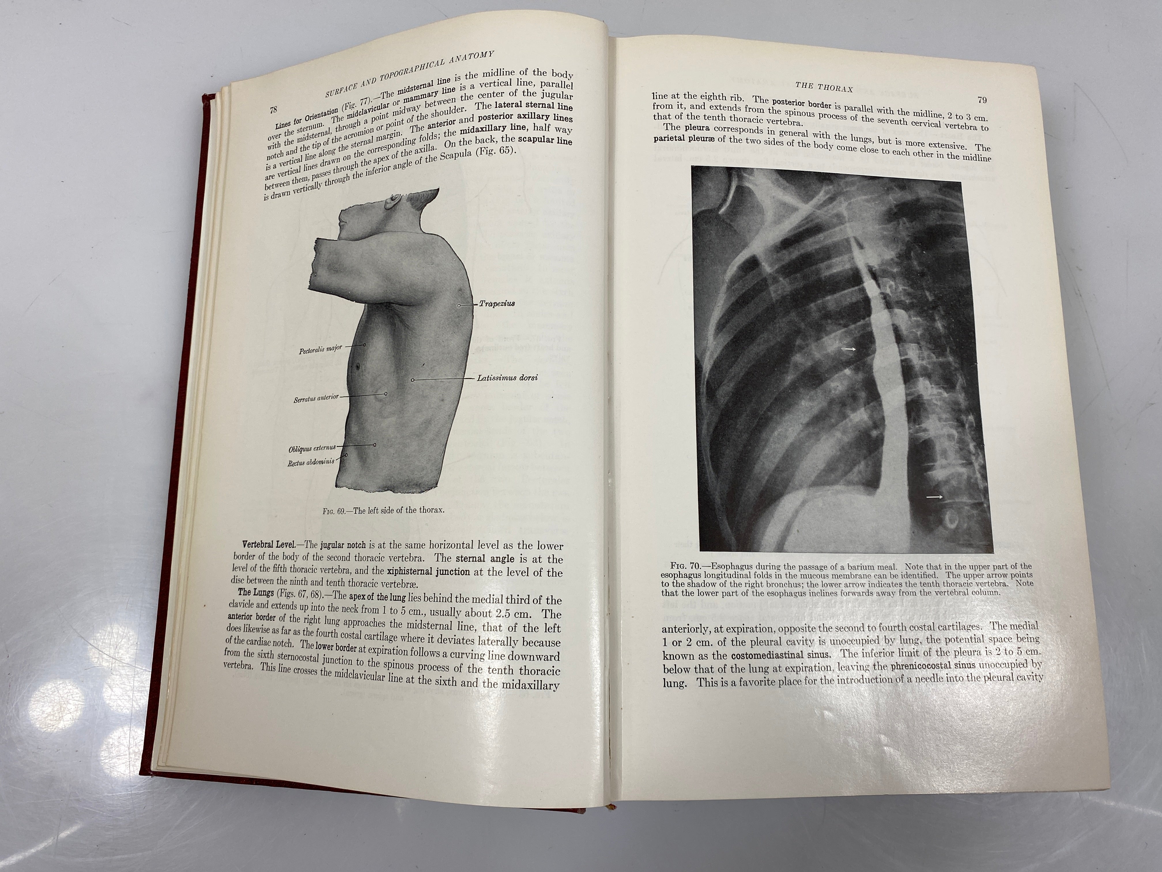 Anatomy of the Human Body by Gray Centennial Edition Lea & Febiger 1959 HC