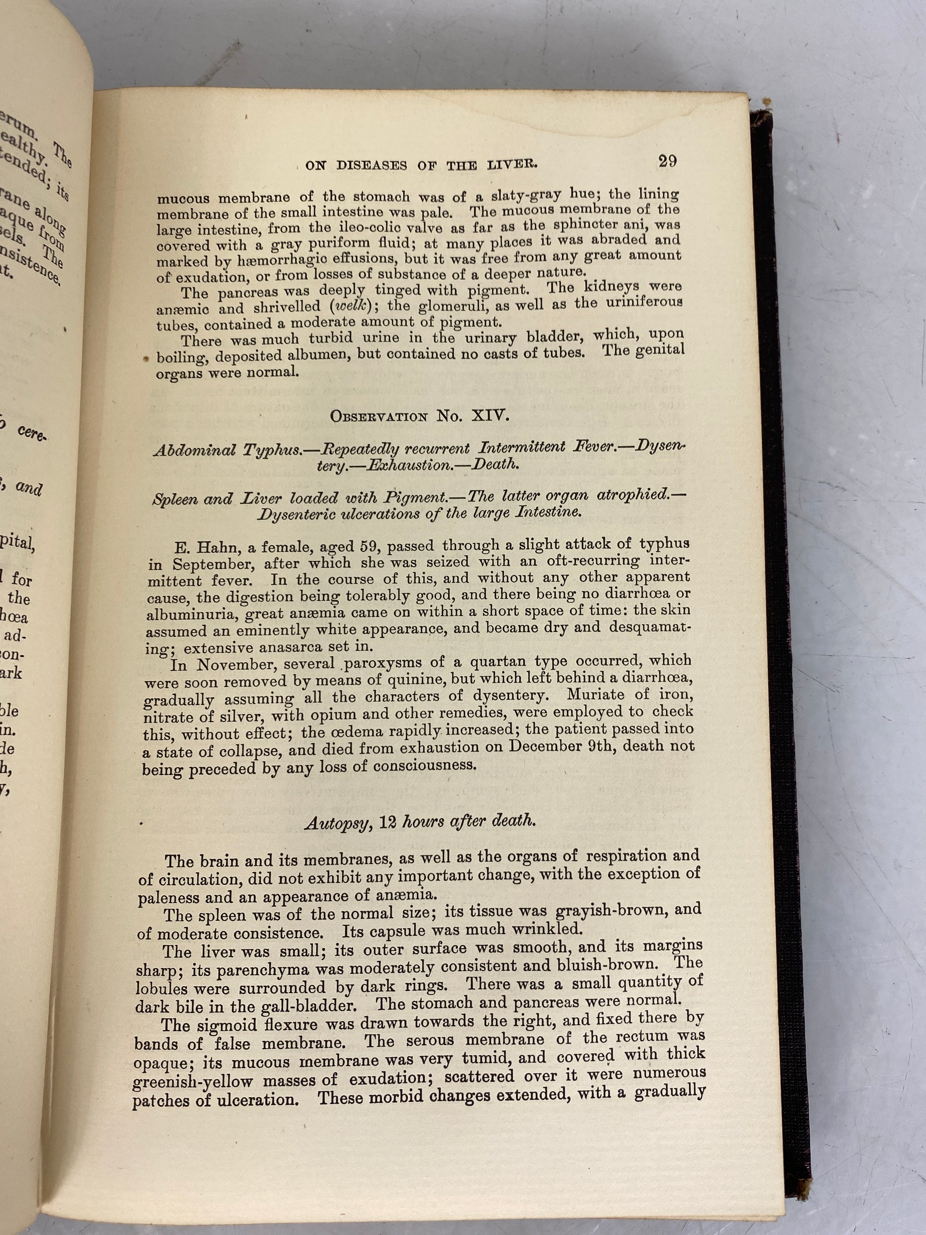 Wood's Medical Library Diseases of the Liver 3 Vol Set by Frerichs 1879 HC