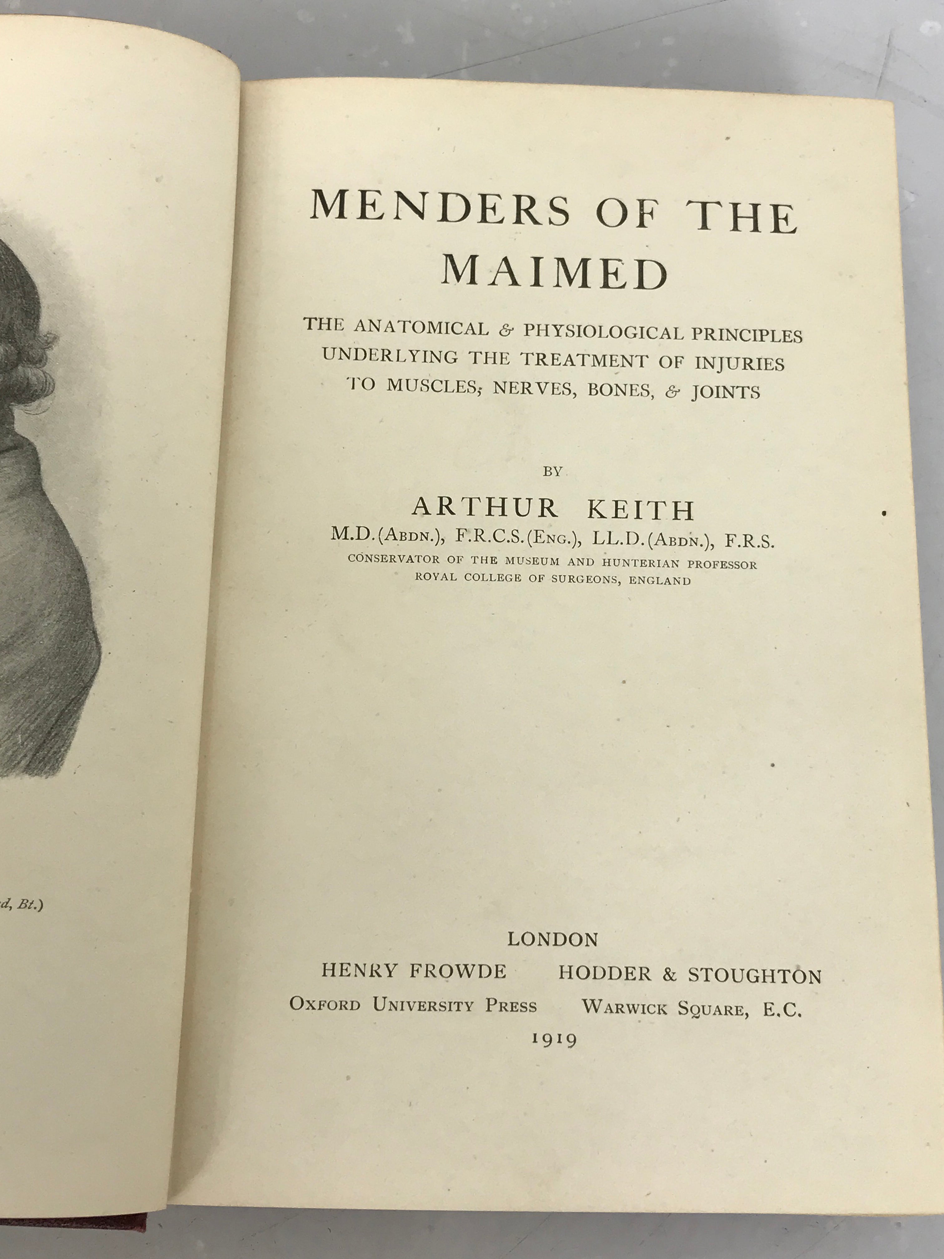 Antique Medical History Book: Menders of the Maimed by Arthur Keith 1919 HC