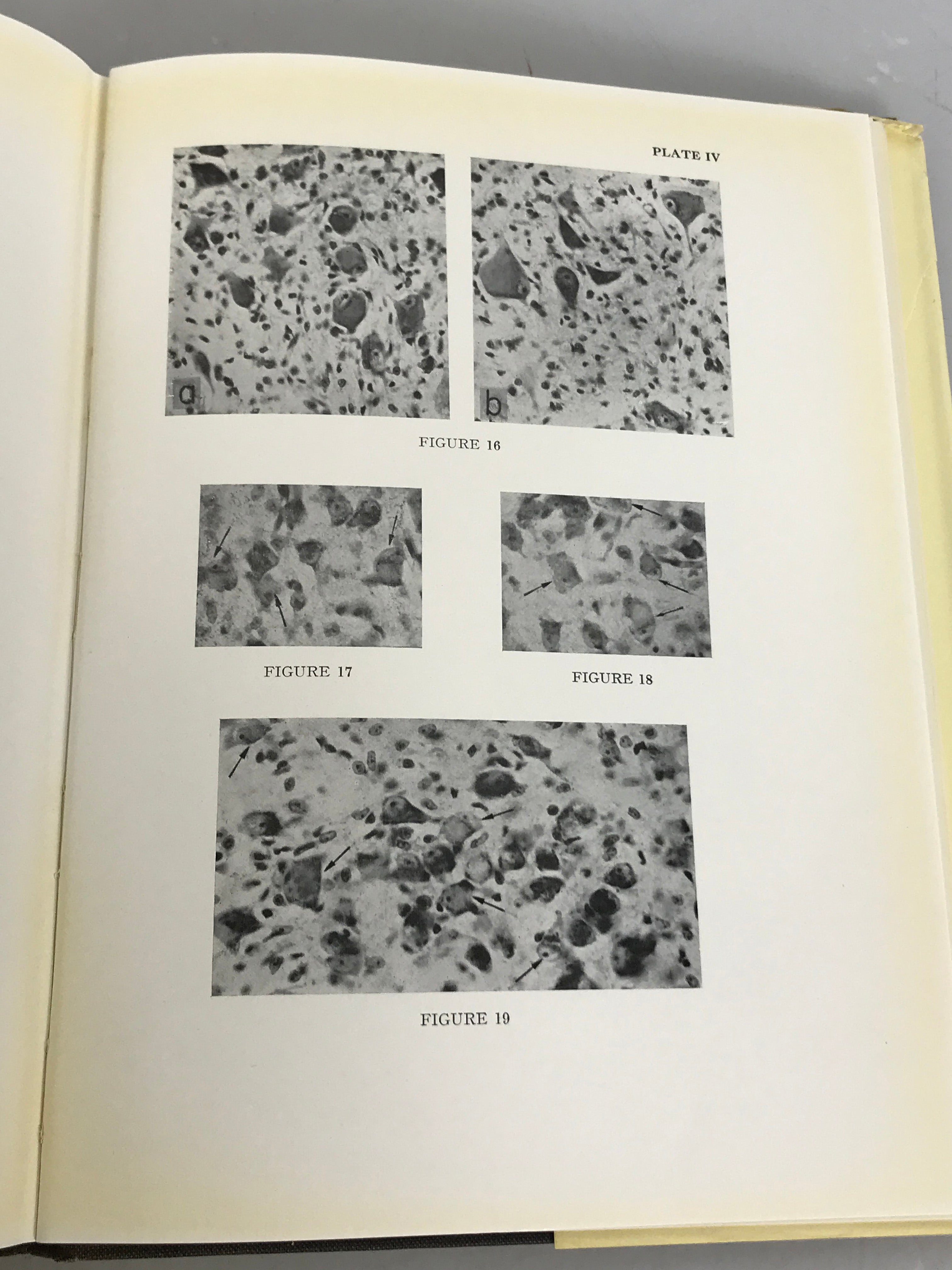 The Vestibular Nuclei and their Connections, Anatomy and Functional Correlations by Brodal, Pompeiano, and Walberg 1962 First Edition HC DJ