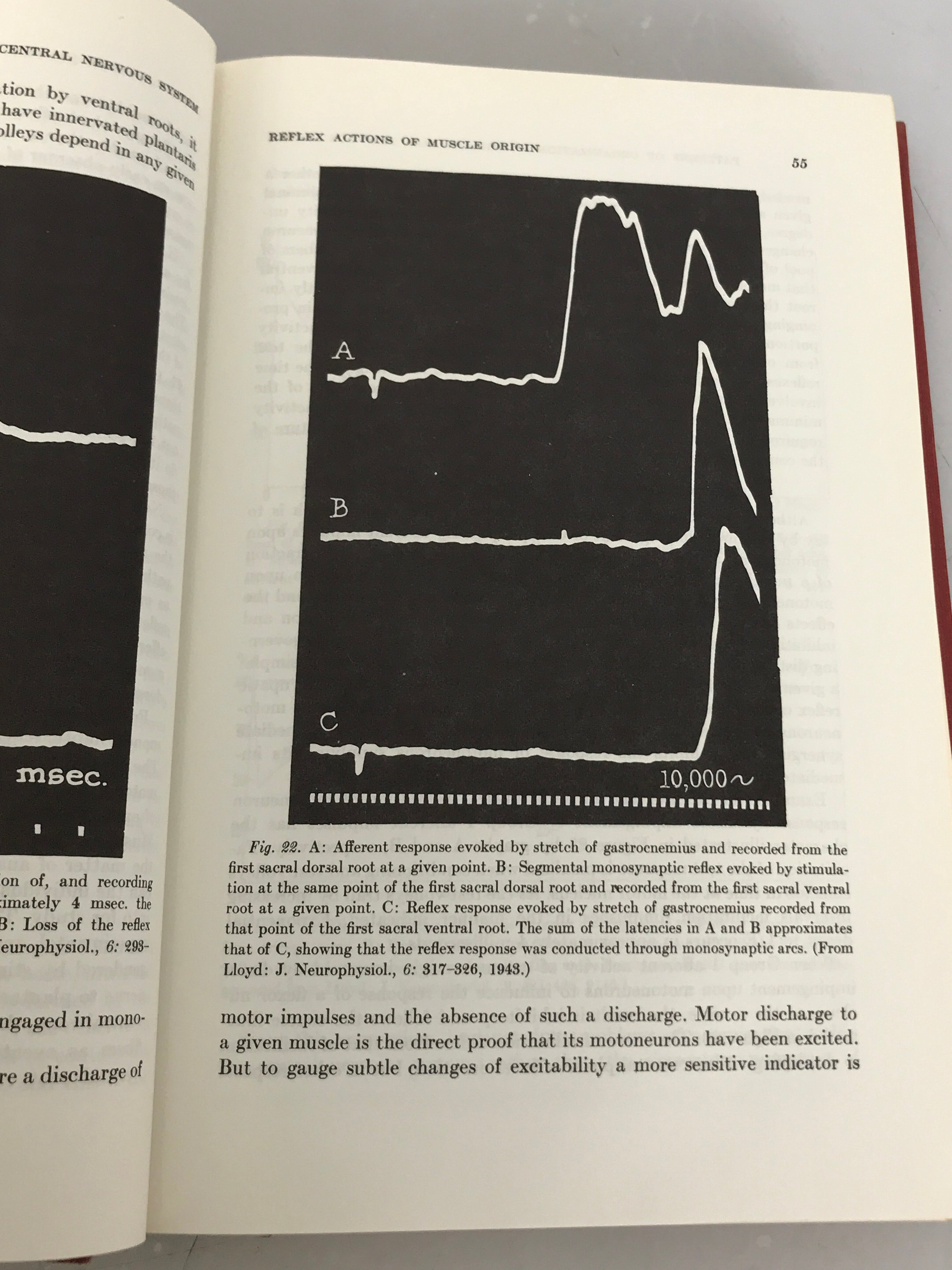 Lot of 2 Central Nervous System Books: Patterns of Organization in the Central Nervous System and Teratology of the Central Nervous System 1968 HC DJ