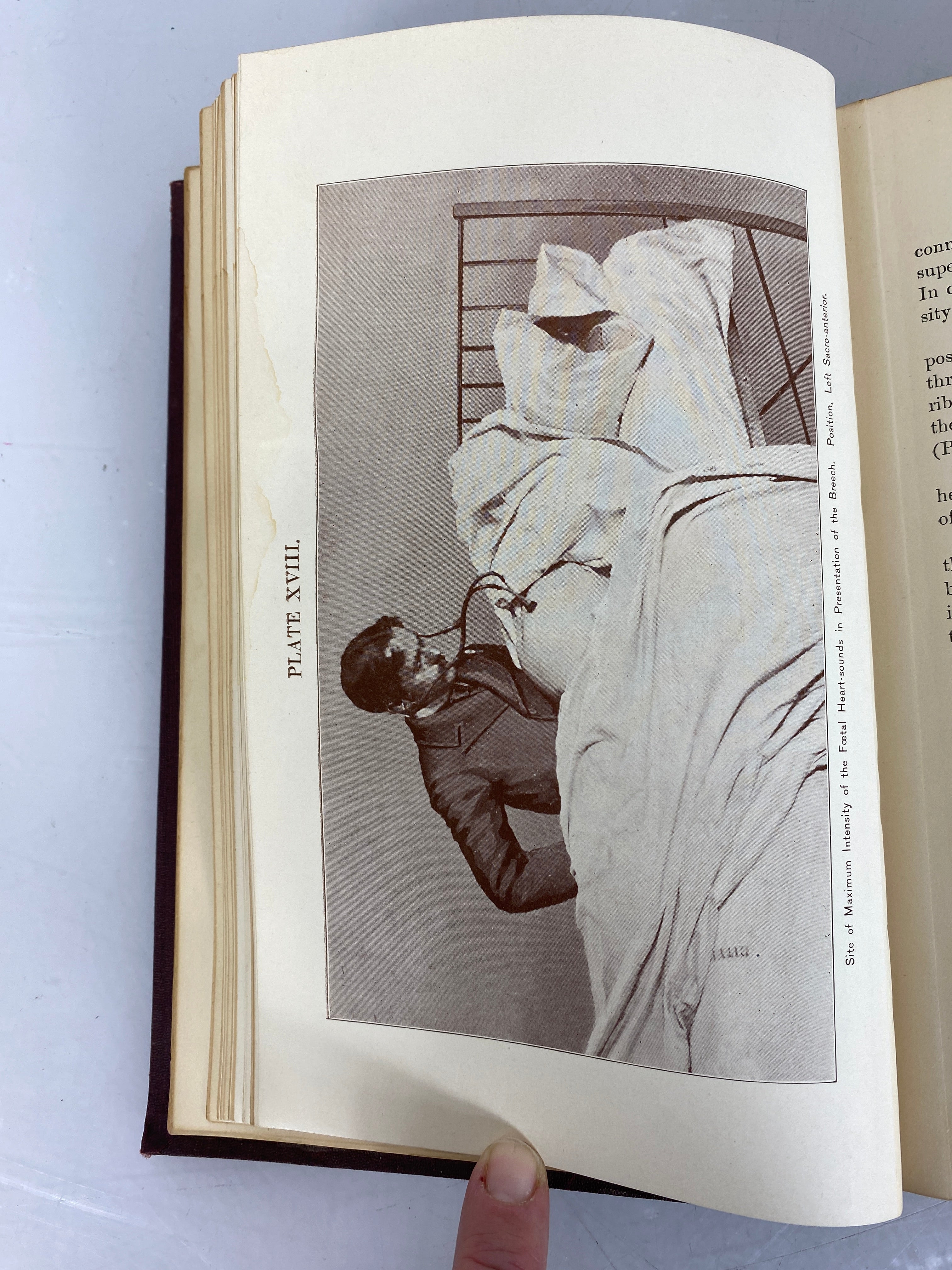 Practical Obstetrics by Egbert H. Grandin and George W. Jarman 1896 HC