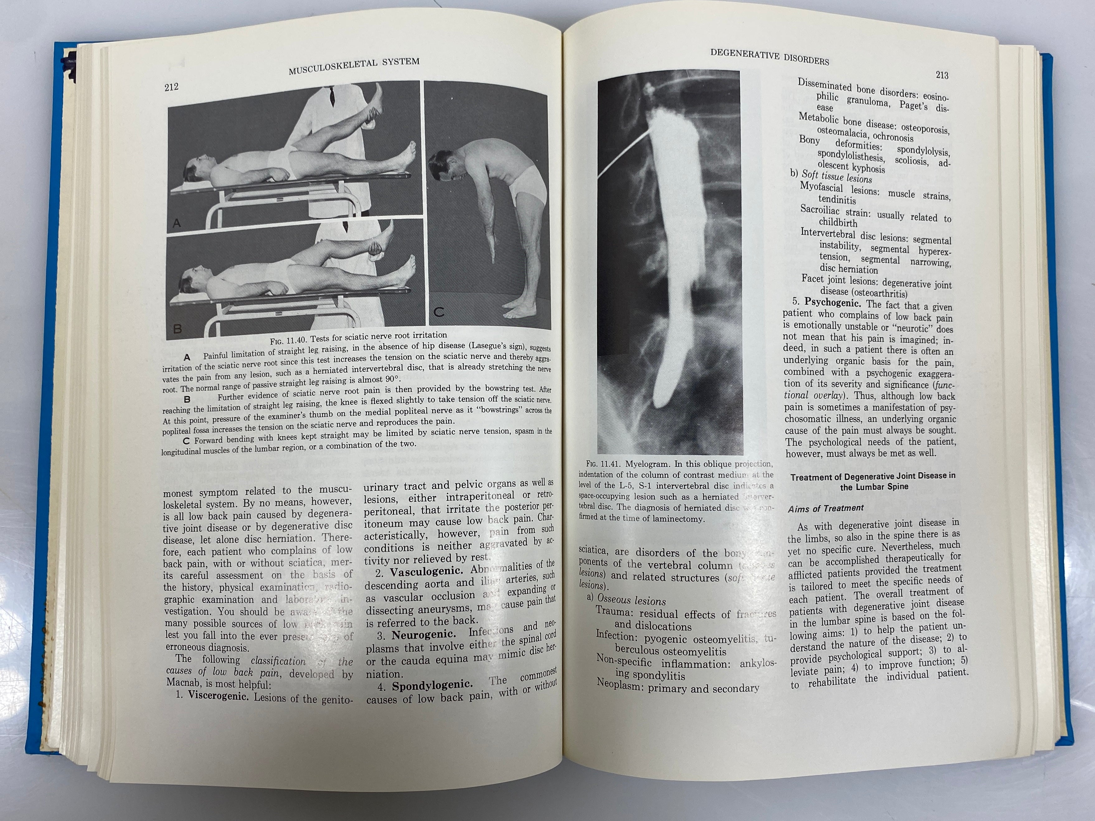 Textbook of Disorders and Injuries of the Musculoskeletal System by Salter 1978