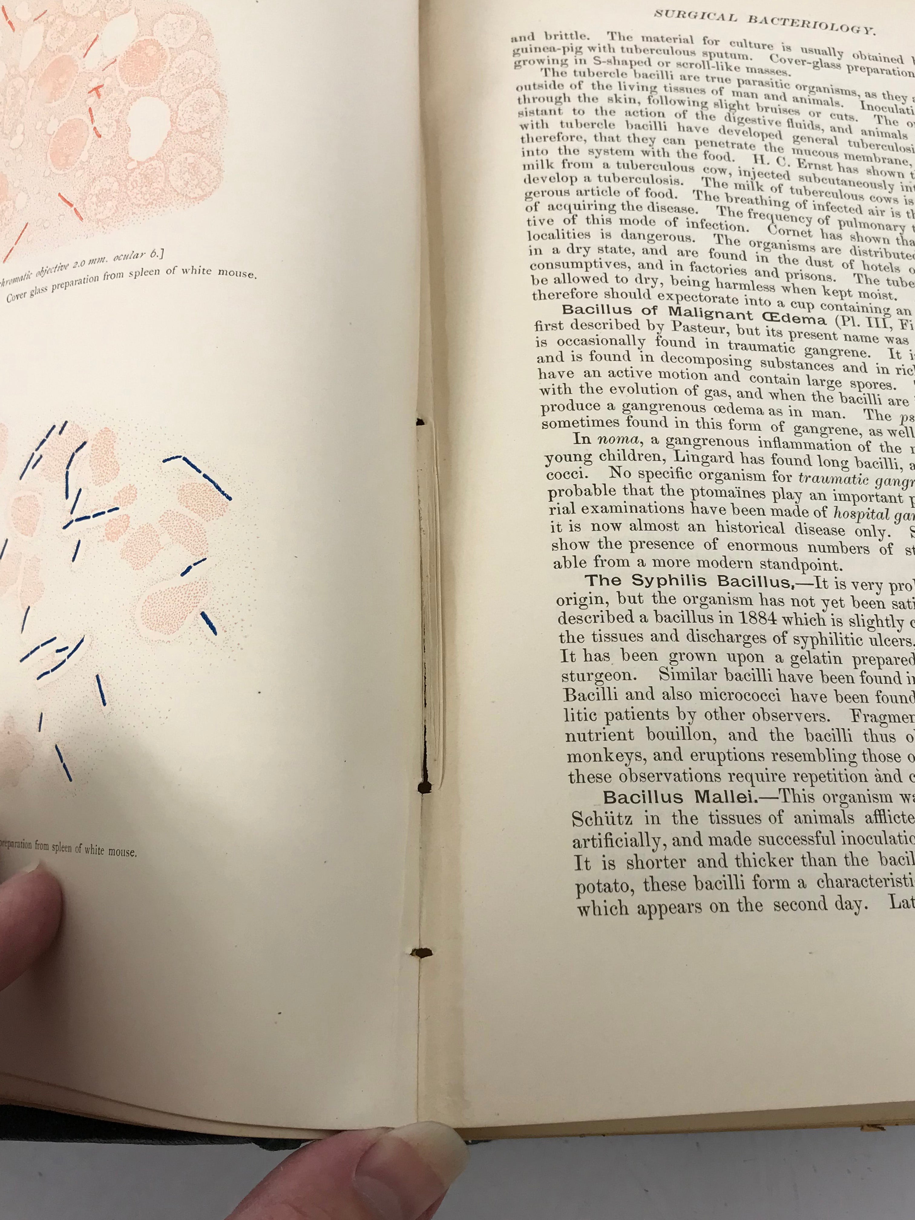 An American Text-Book of Surgery Keen and White 1893 HC