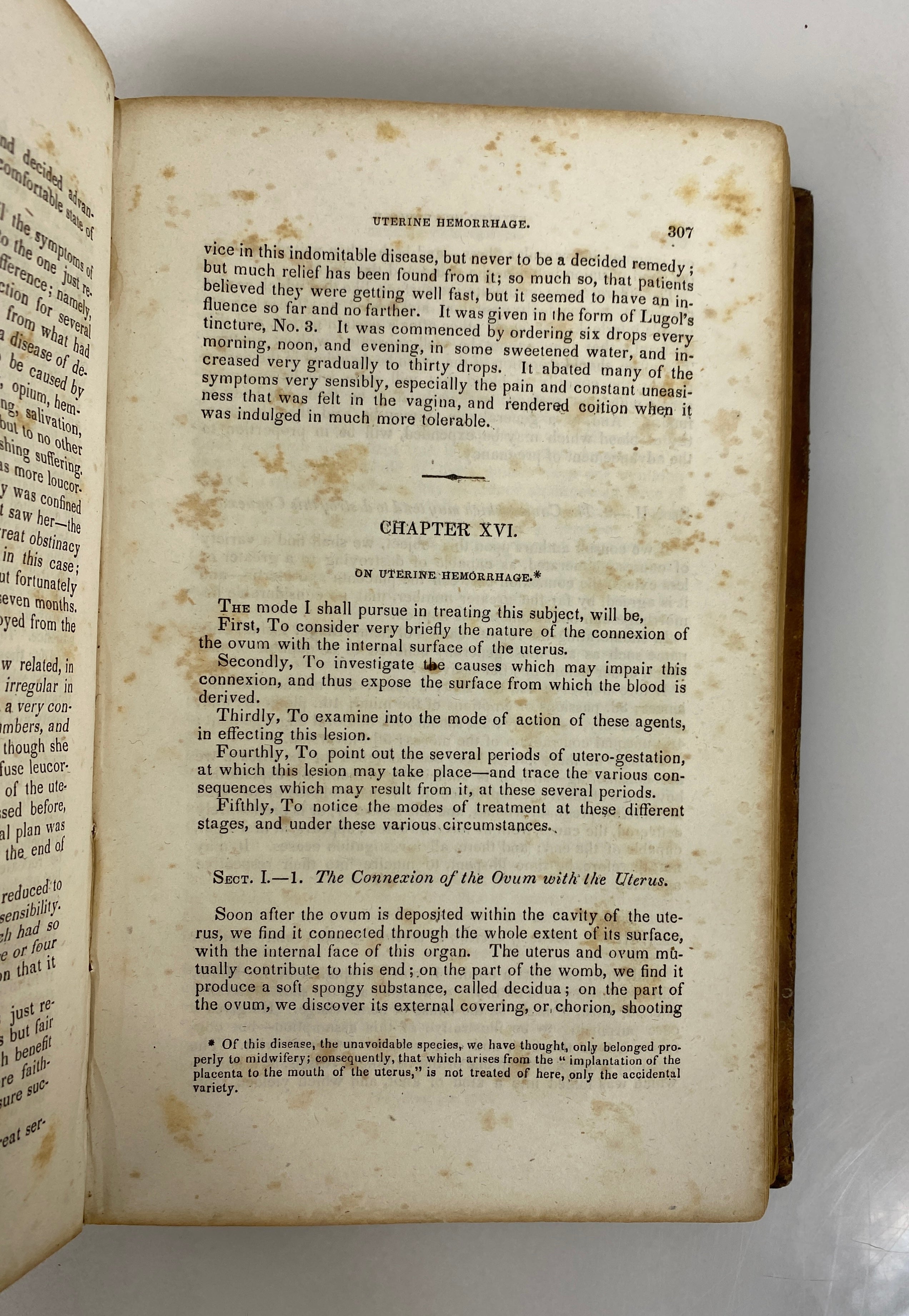 A Treatise on the Diseases of Females William DeWees 1843 Antique Leather Bound