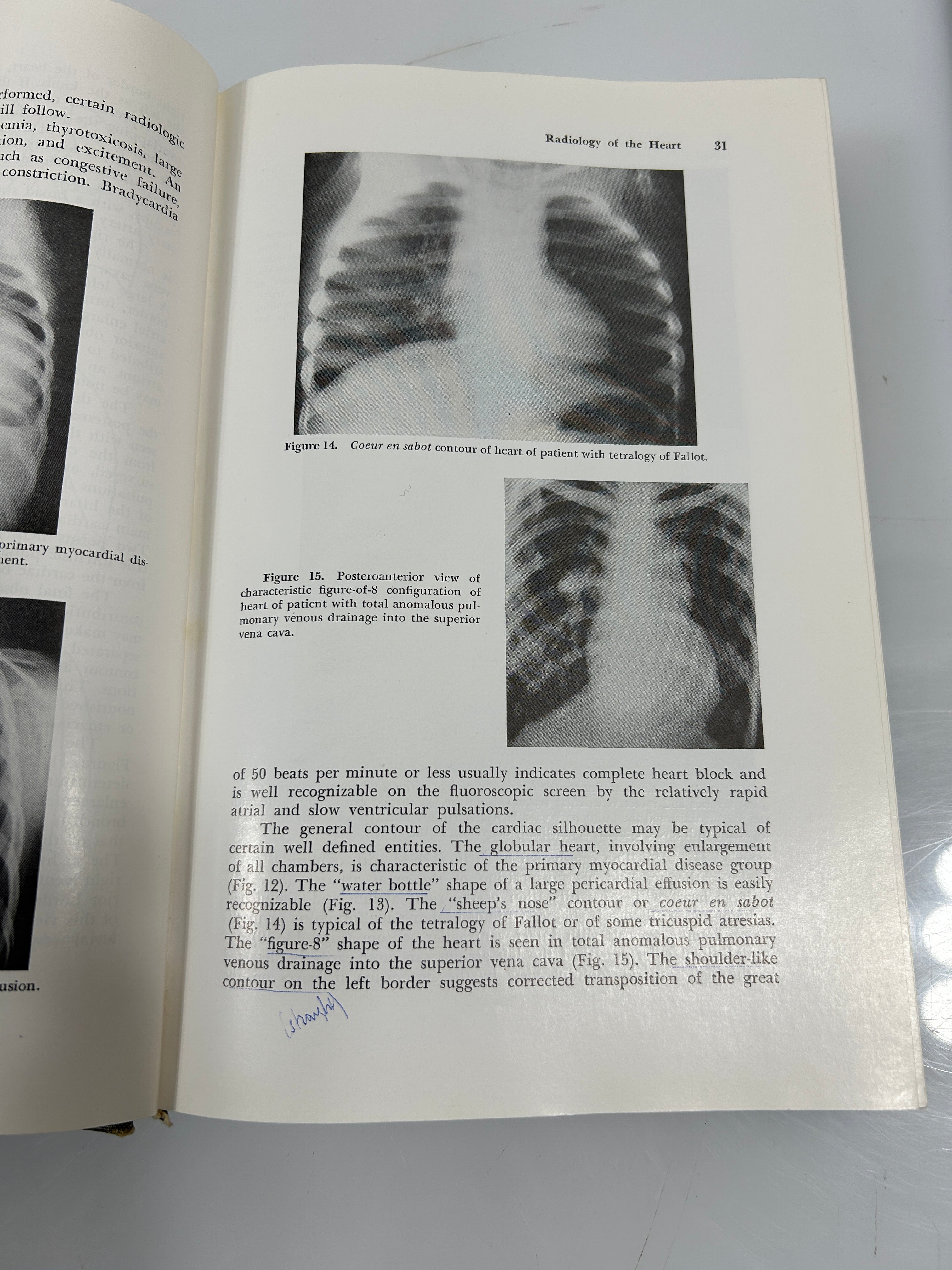 2 Vols: Pediatric Cardiology/CIBA Collection of Medical Illustrations Heart HC