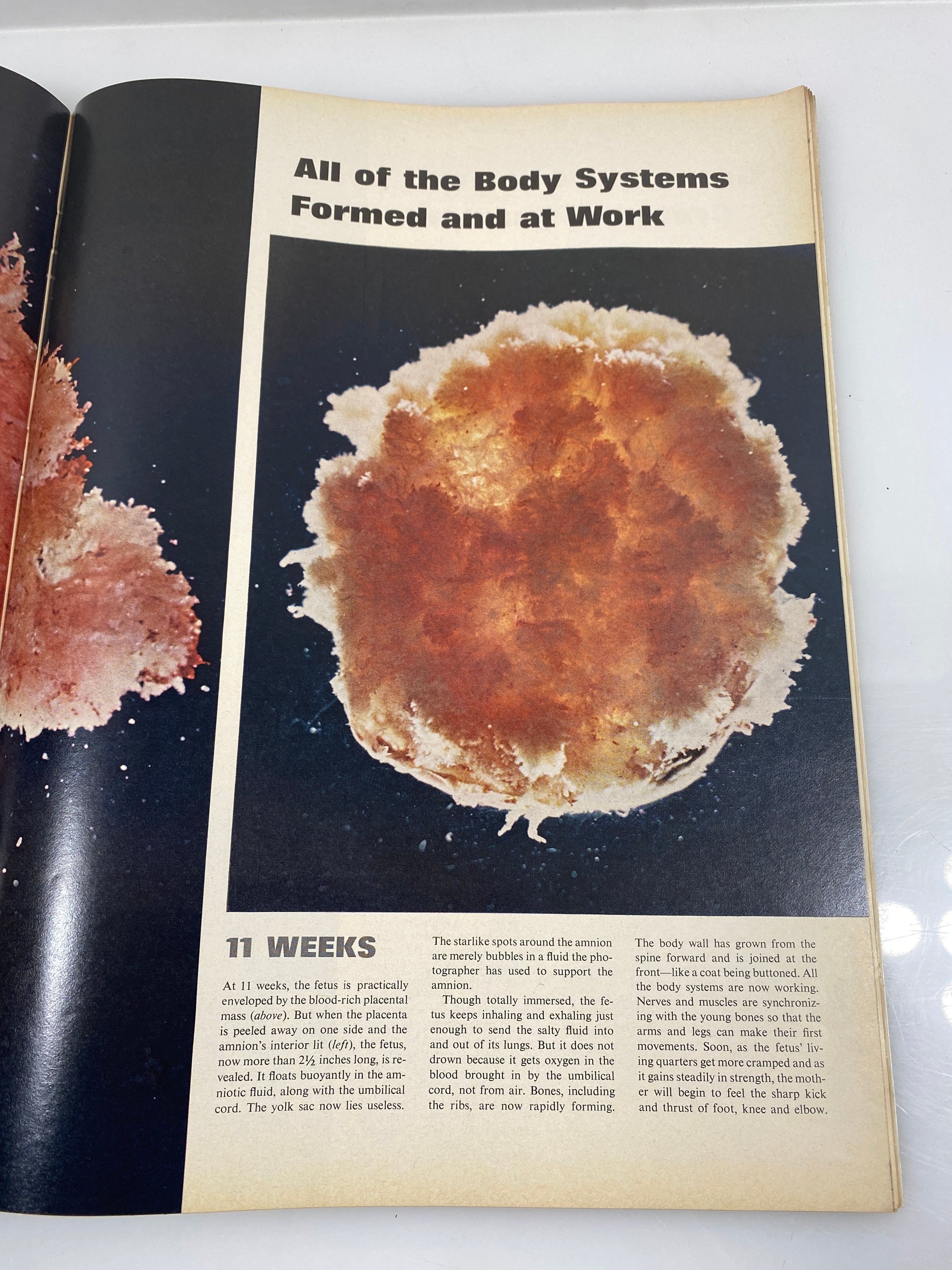 Life Magazine Drama Before Birth April 30, 1965