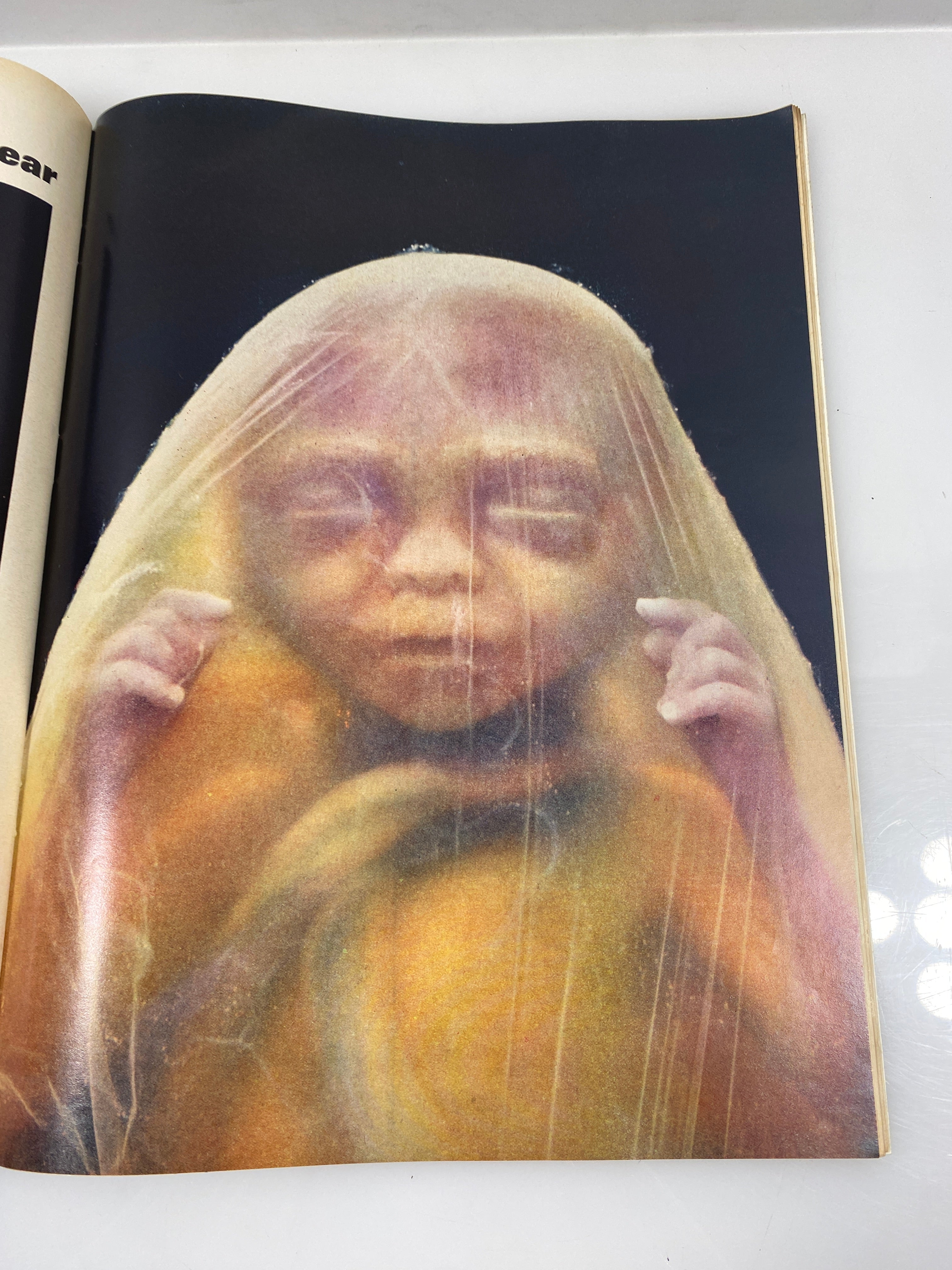 Life Magazine Drama Before Birth April 30, 1965