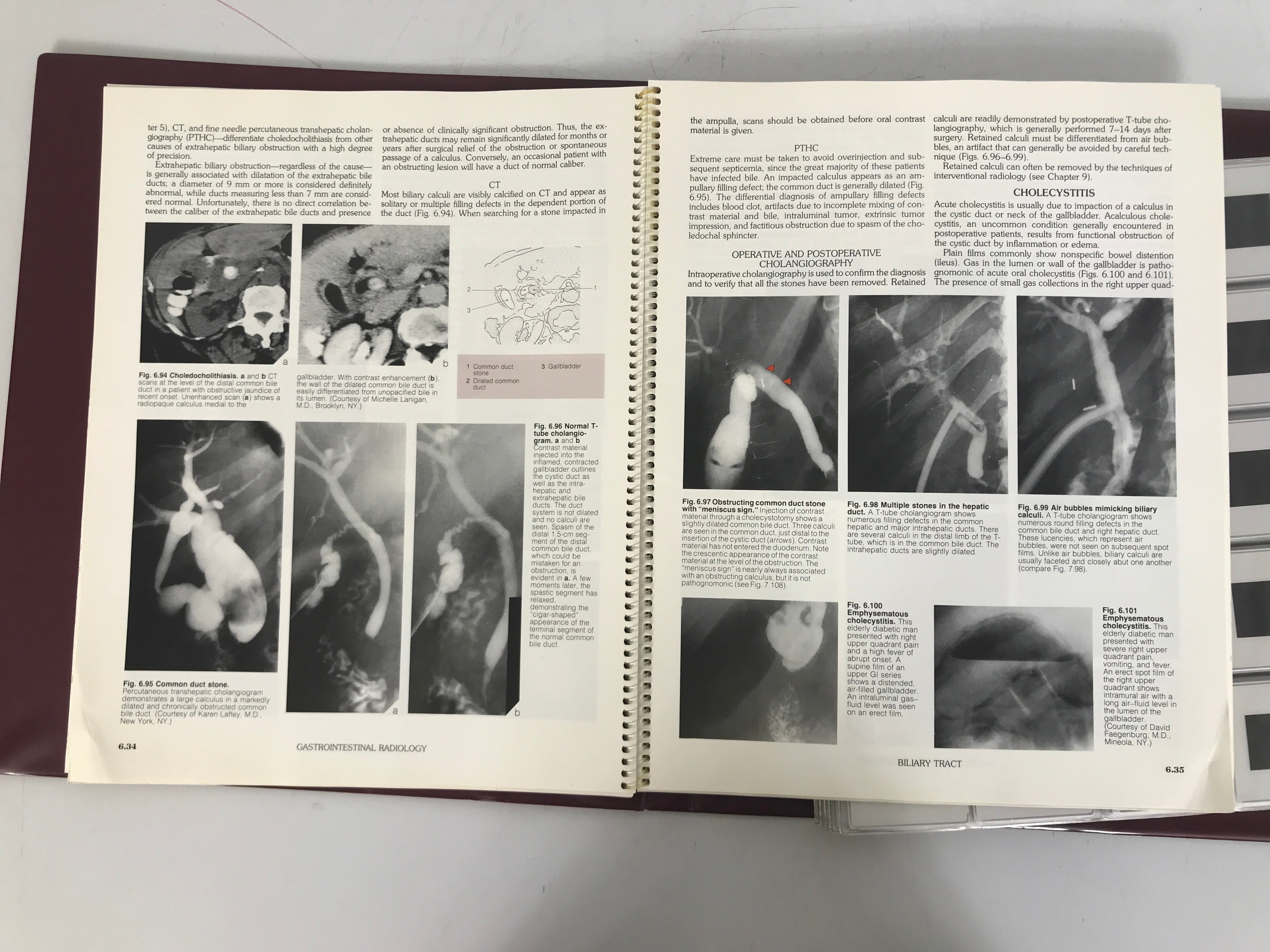 Slide Atlas of Radiological Imaging Gastrointestinal Radiology 1989 by Farman