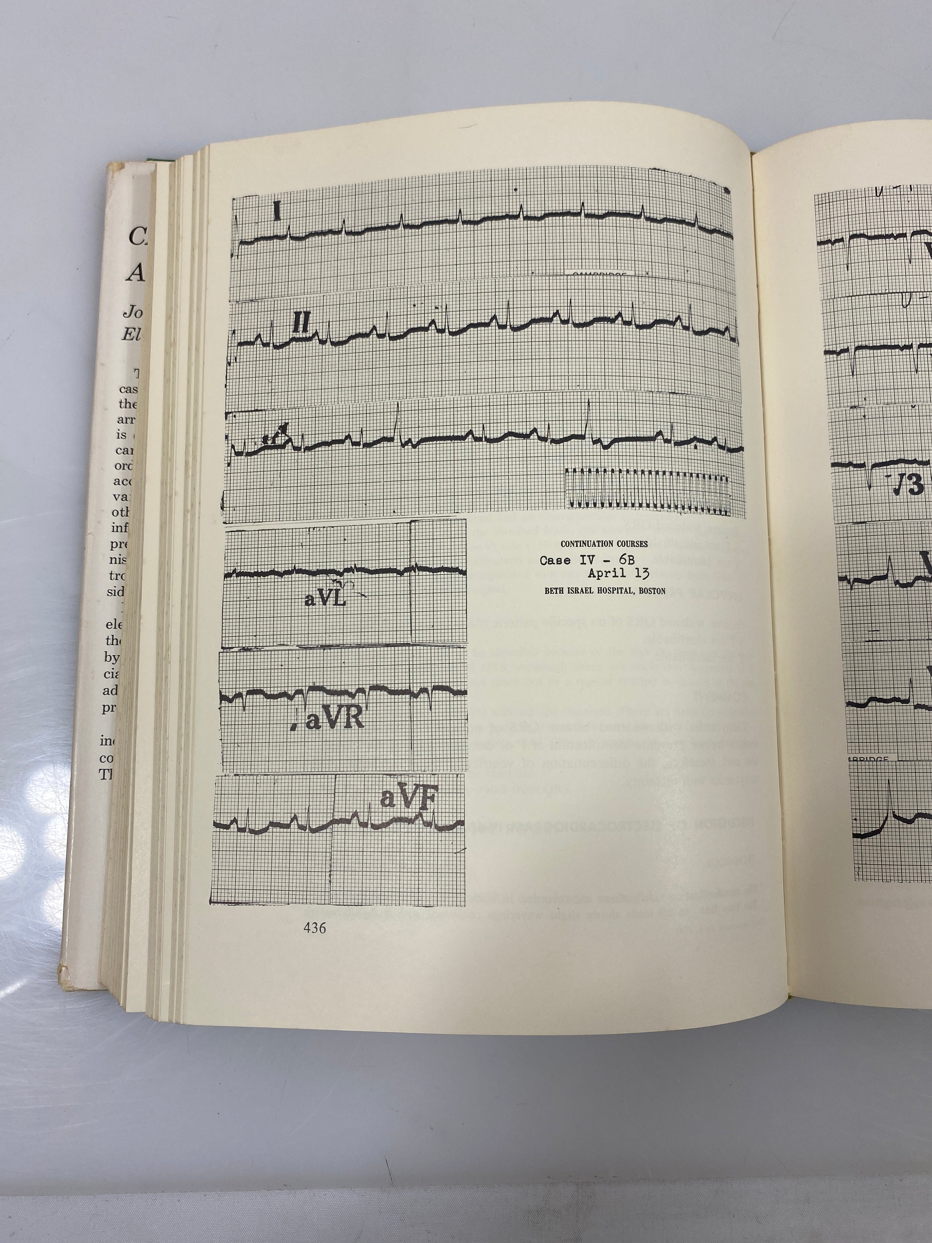 Cardiac Arrhythmias by Riseman/Sagall 1963 HCDJ