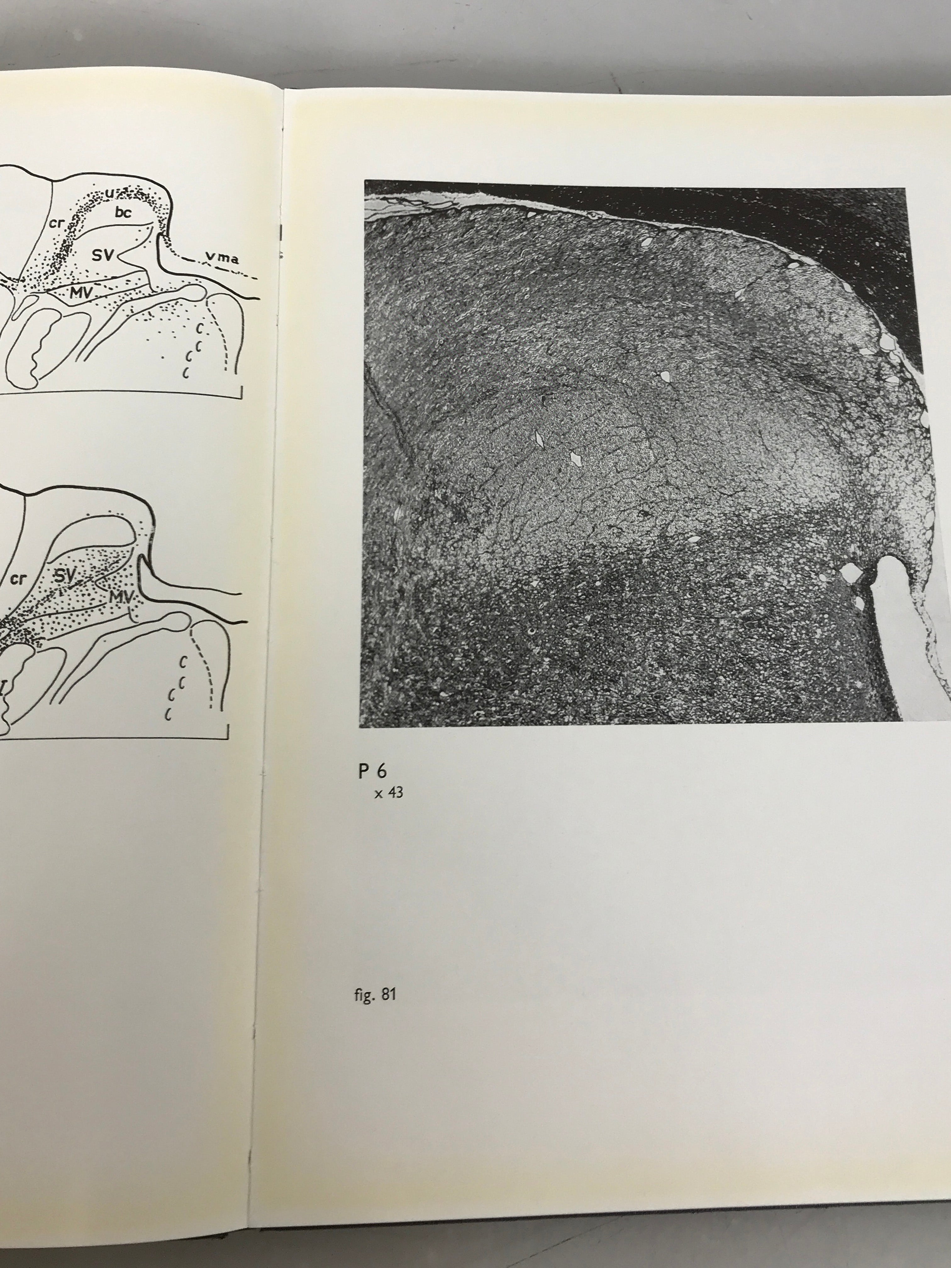2 Volume Set: A Stereotactic Atlas of the Brain Stem of the Cat by W.J.C. Verhaart 1964 HC