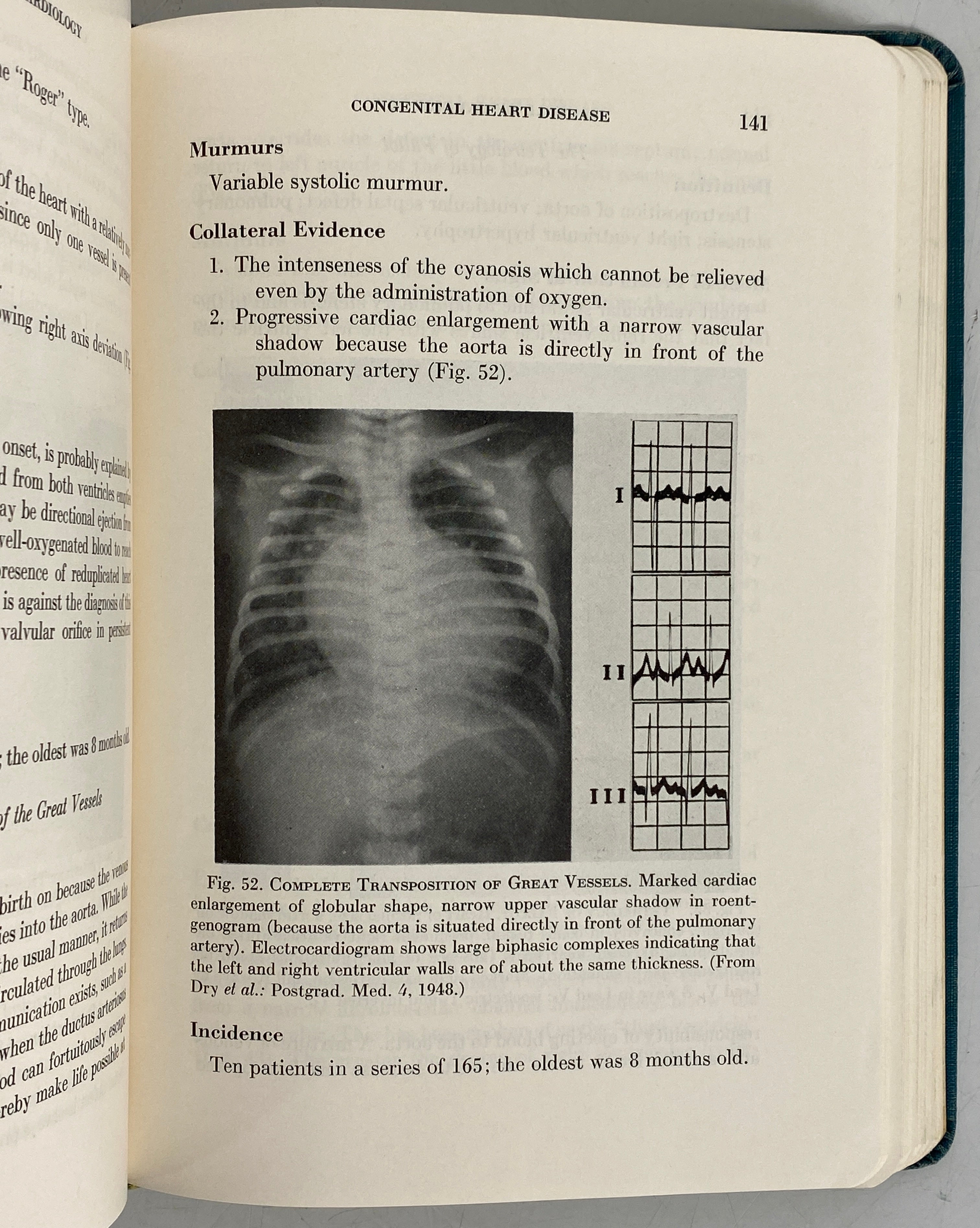 A Manual of Cardiology by Thomas Dry 1950 Second Edition SC
