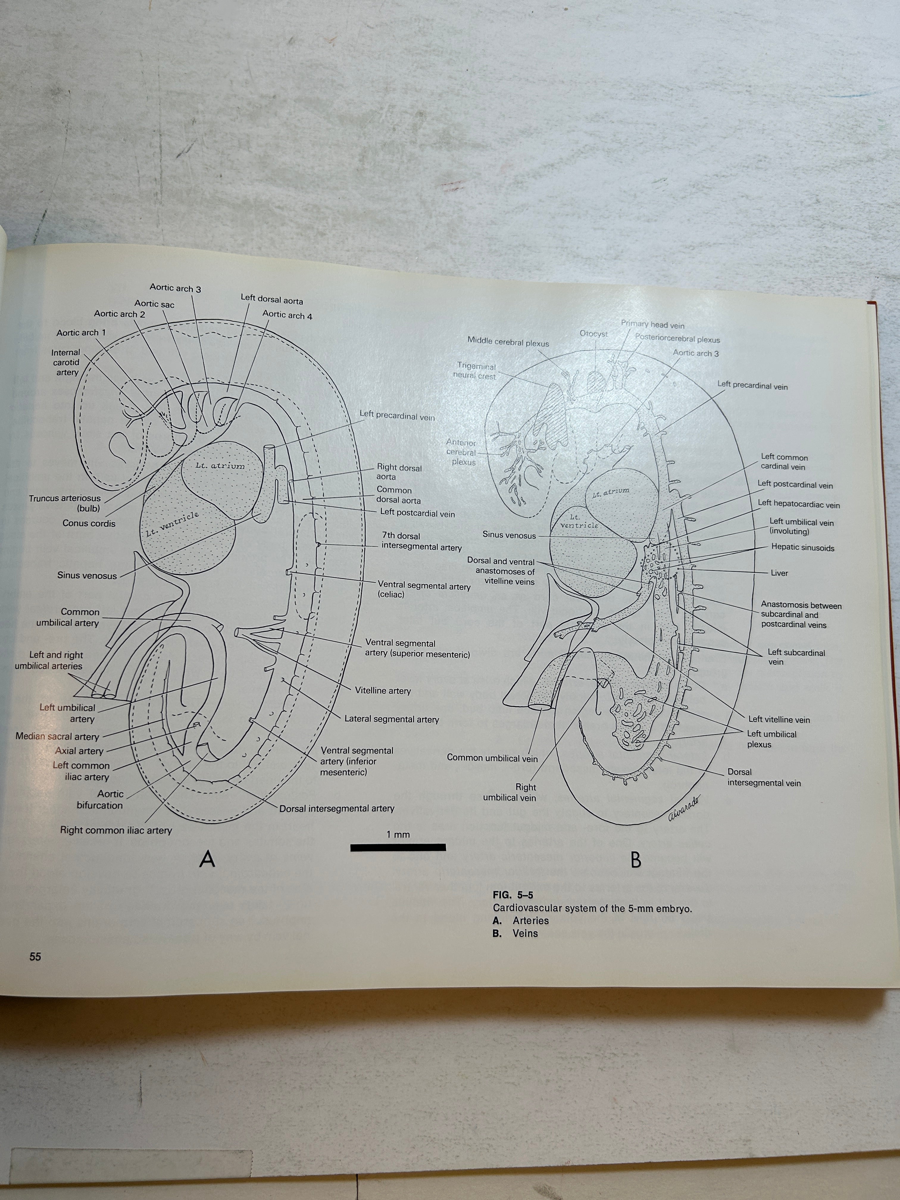 Atlas of Human Embryos *signed* Raymond F. Gasser Harper & Row 1975 HC