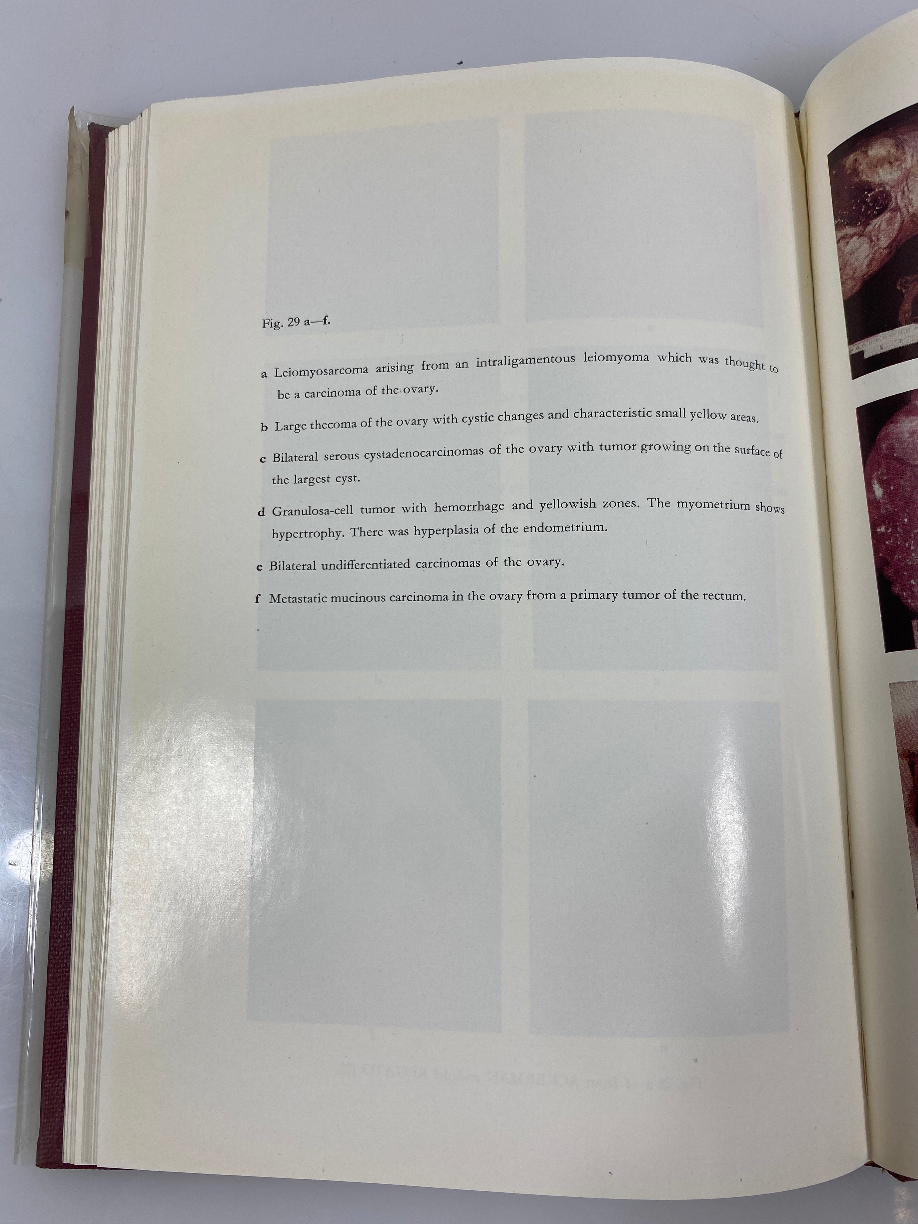 Cancer by Alexander Berglas Institute Pasteur Ex-library 1957 HCDJ