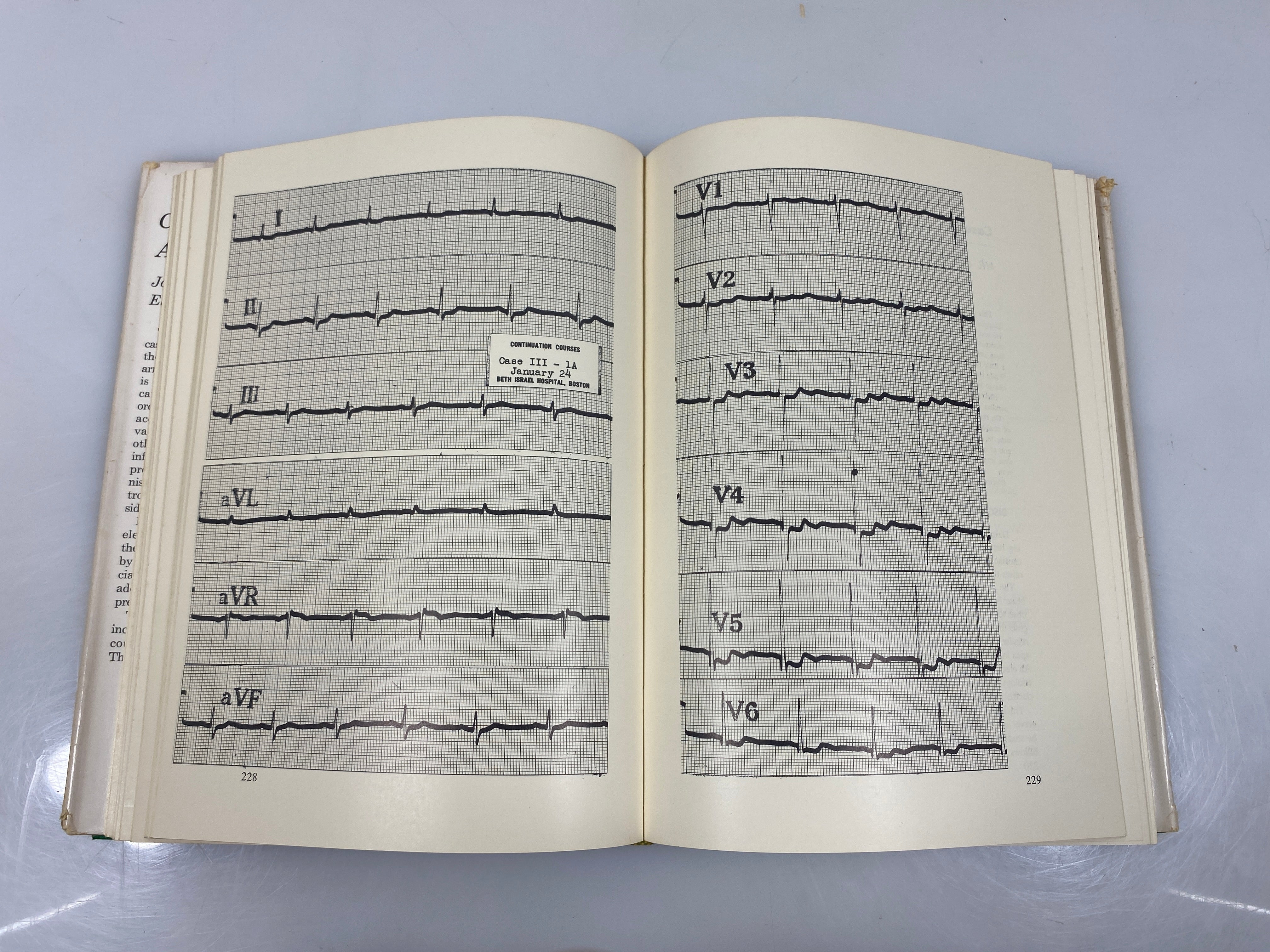 Cardiac Arrhythmias by Riseman/Sagall 1963 HCDJ