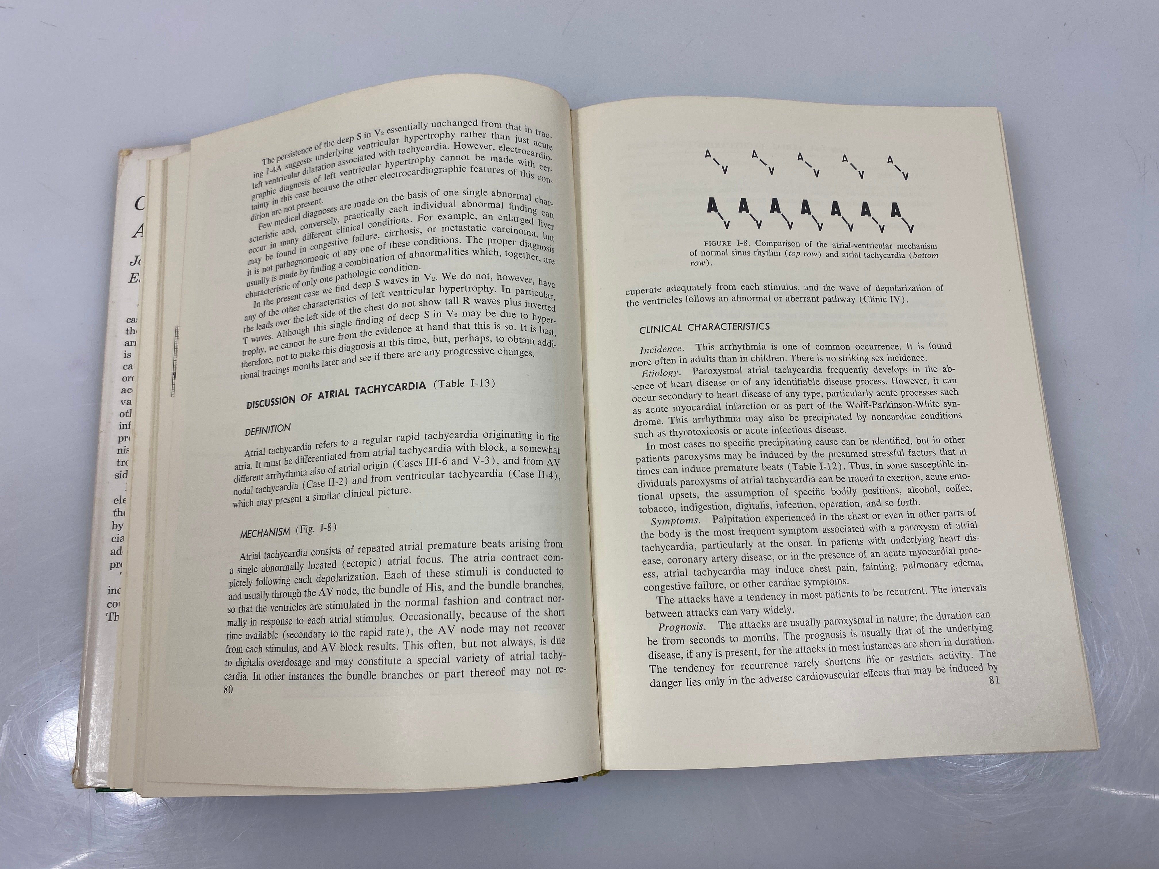Cardiac Arrhythmias by Riseman/Sagall 1963 HCDJ