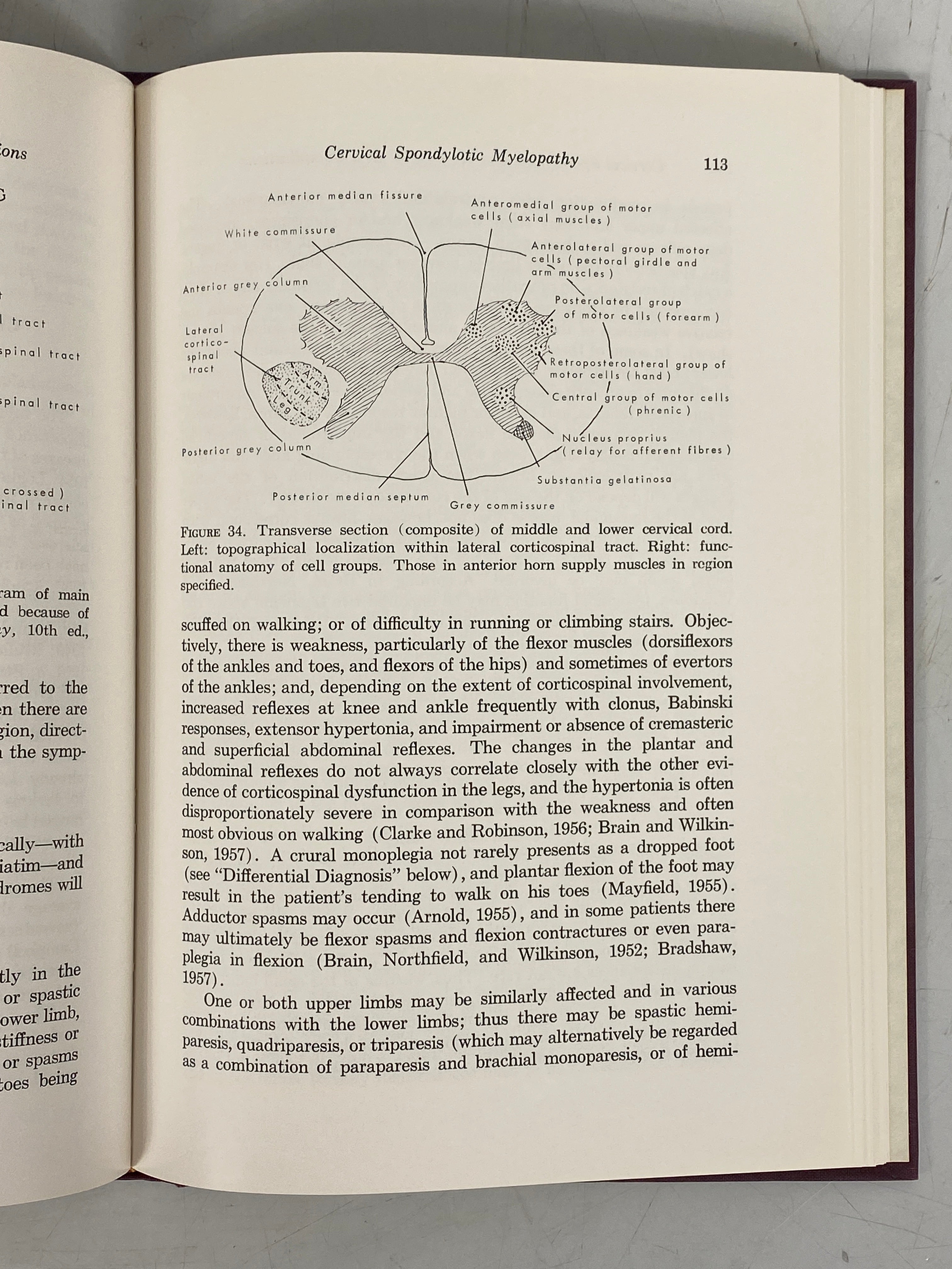Cervical Spondylosis and its Neurological Complications Bernard Smith 1968 HCDJ