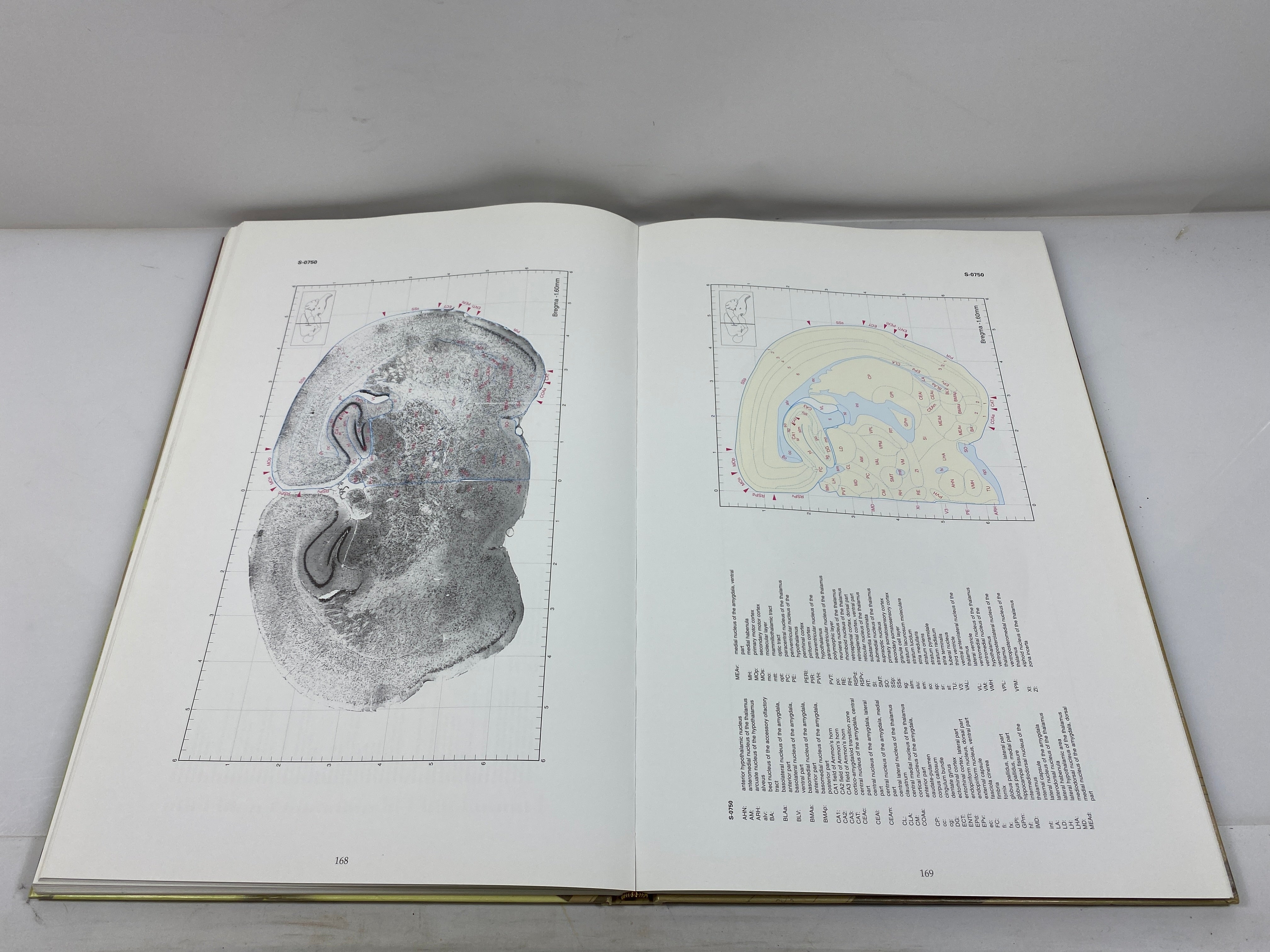 Comparative Cytoarchitectonic Atlas of C57BL/6 & 129/Sv Mouse Brains Hof 2000 HC