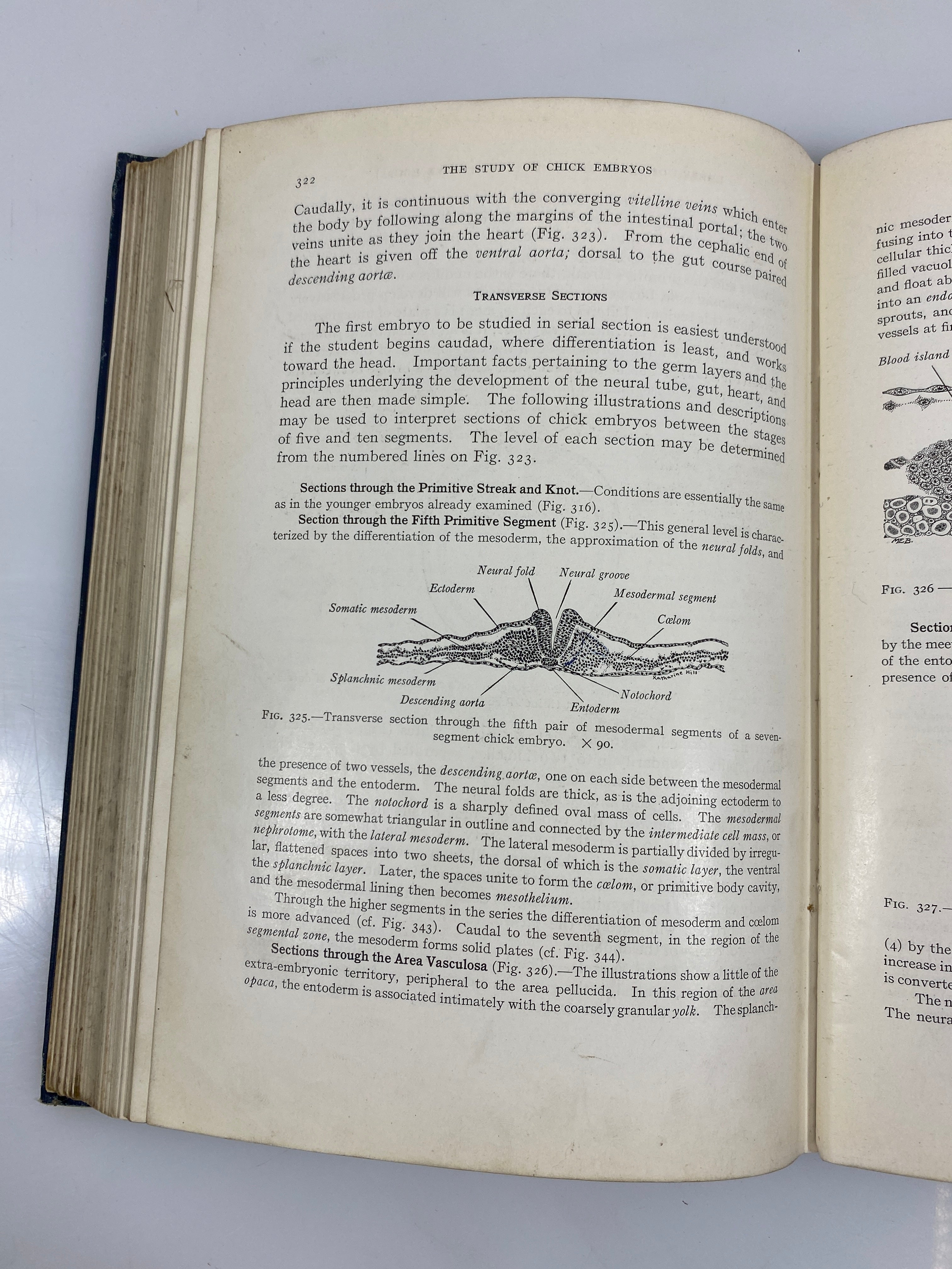 Developmental Anatomy Arey WB Saunders 1925 HC