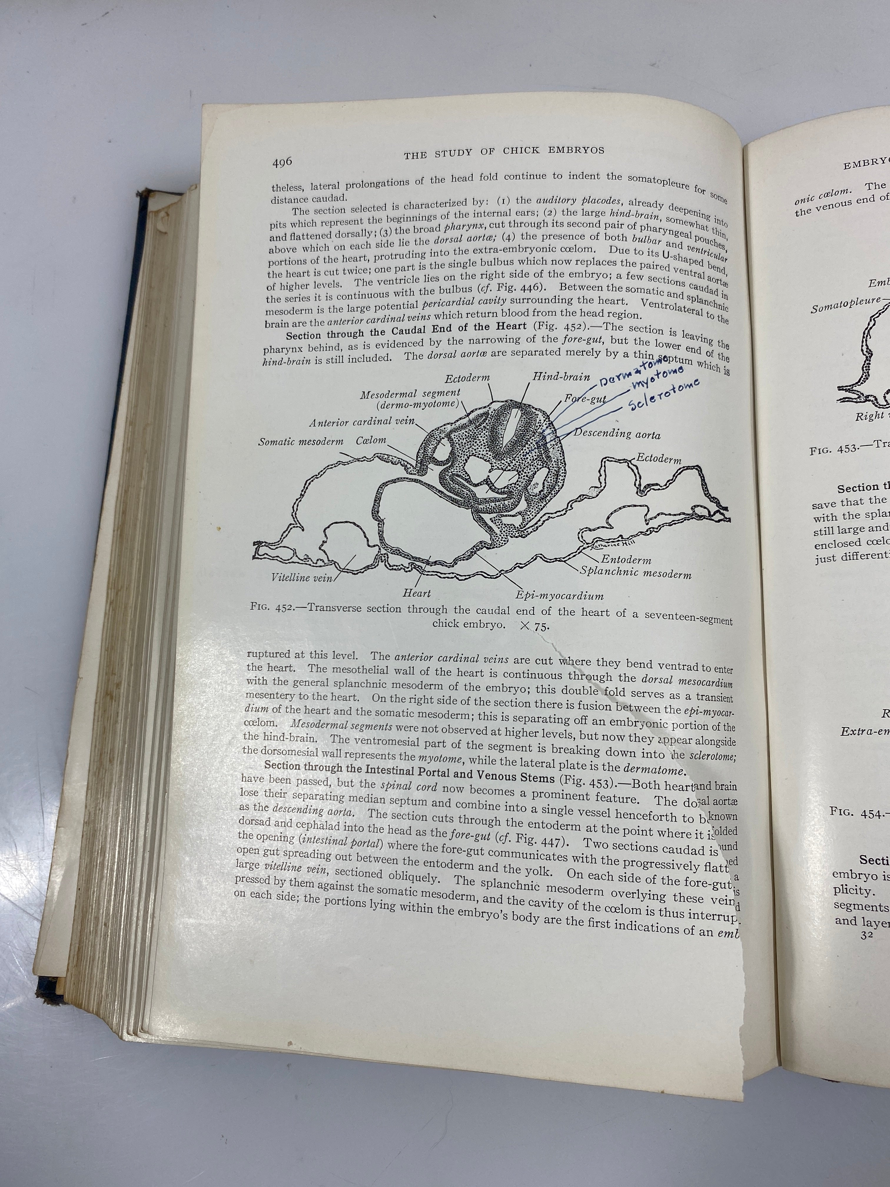Developmental Anatomy by Arey 3rd Ed. 1938 HC