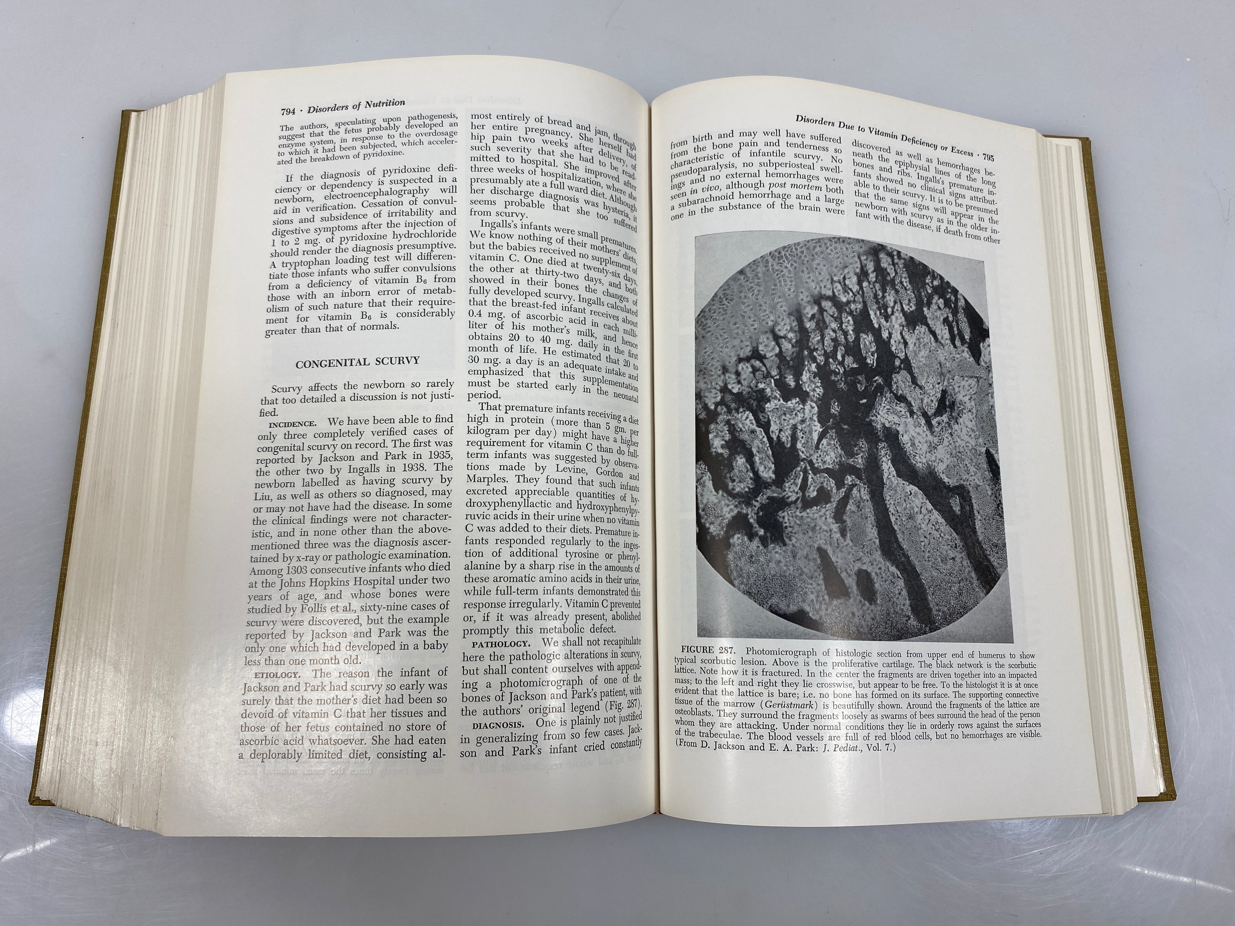 Diseases of the Newborn by Schaffer/Markowitz/Finberg 1966 HC