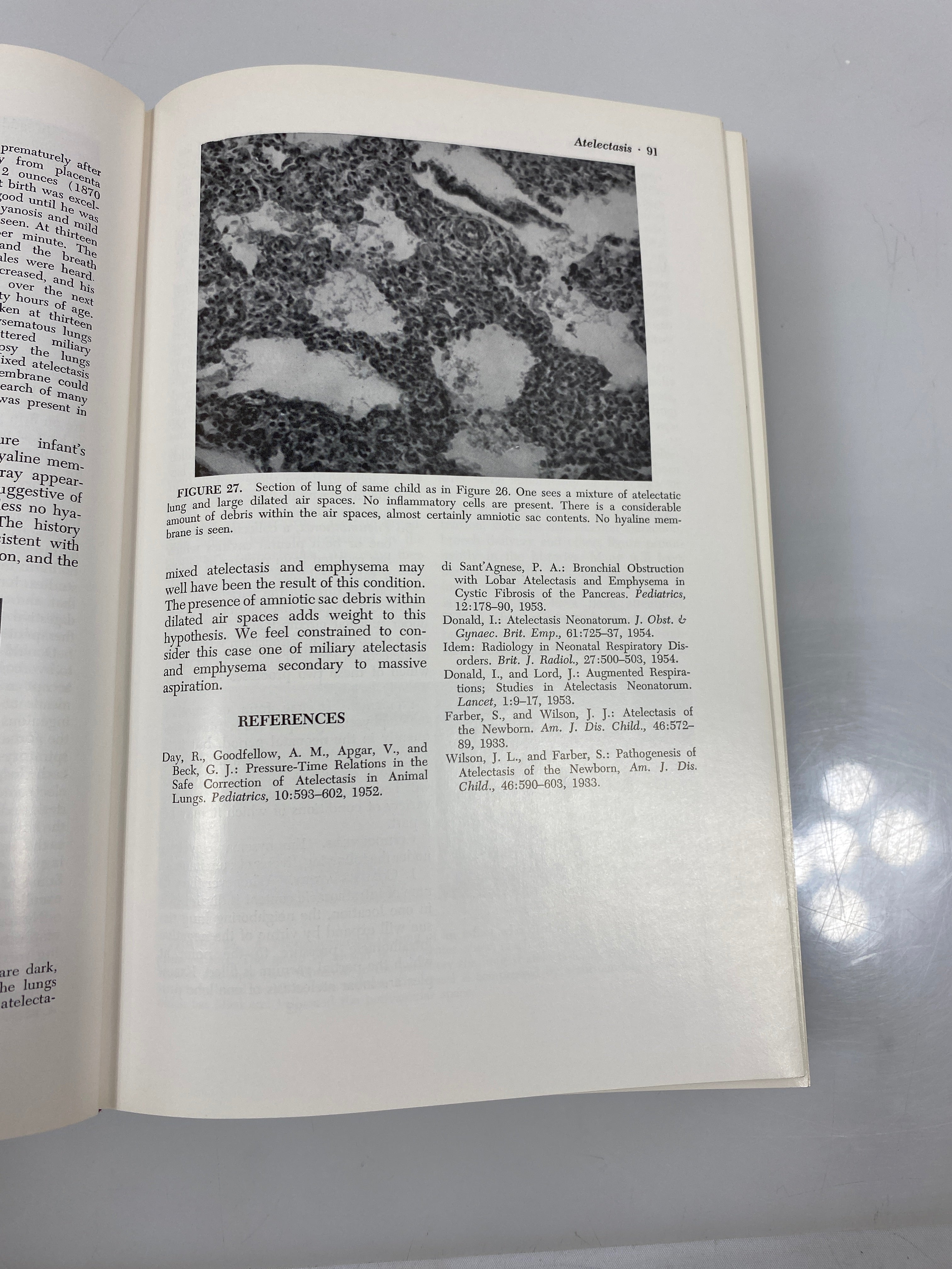 Diseases of the Newborn by Schaffer/Markowitz/Finberg 1966 HC