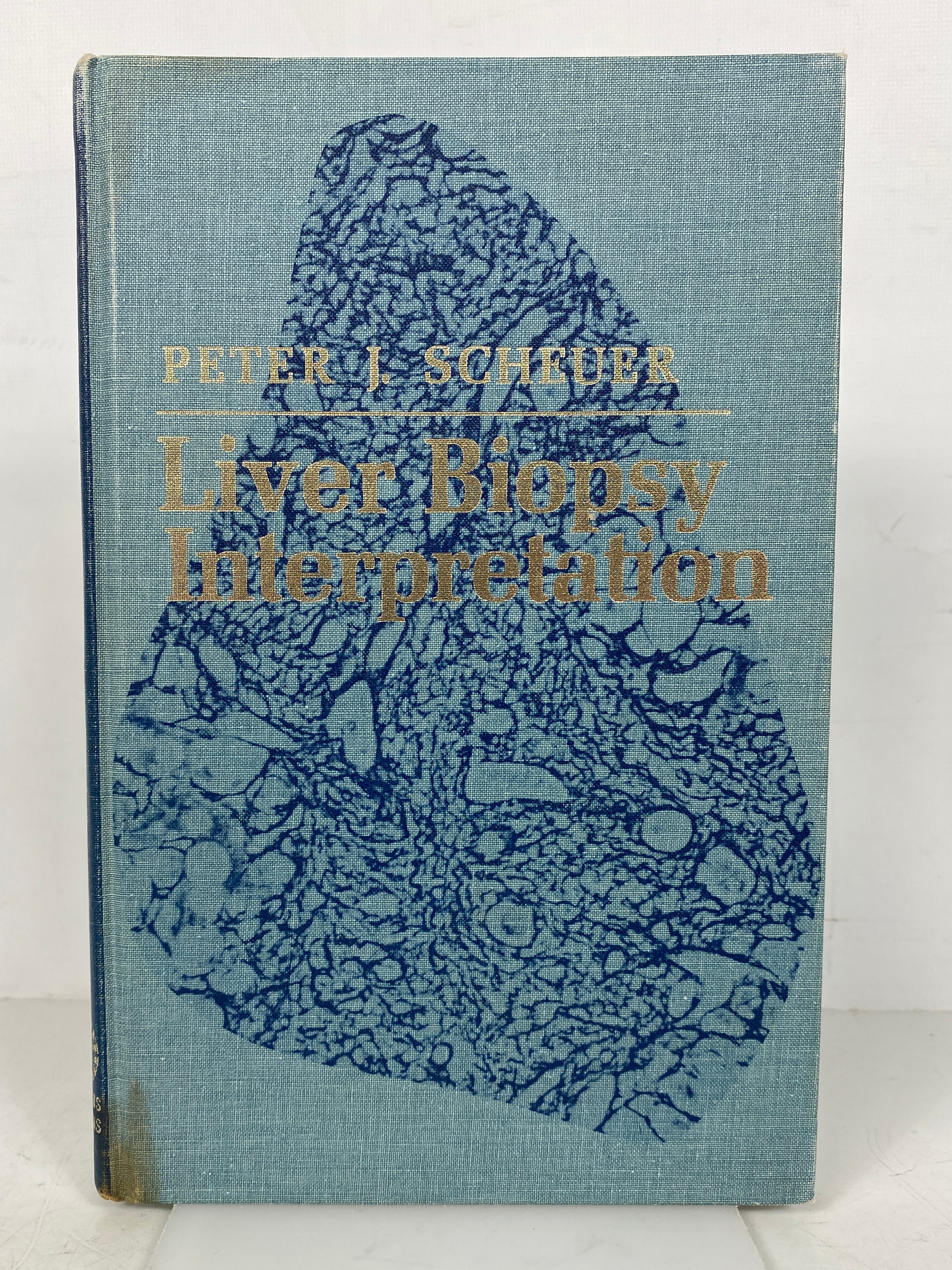 Liver Biopsy Interpretation Peter Scheuer 1970 1st Ed Reprint HC