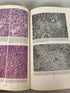 Liver Biopsy Interpretation Peter Scheuer 1970 1st Ed Reprint HC