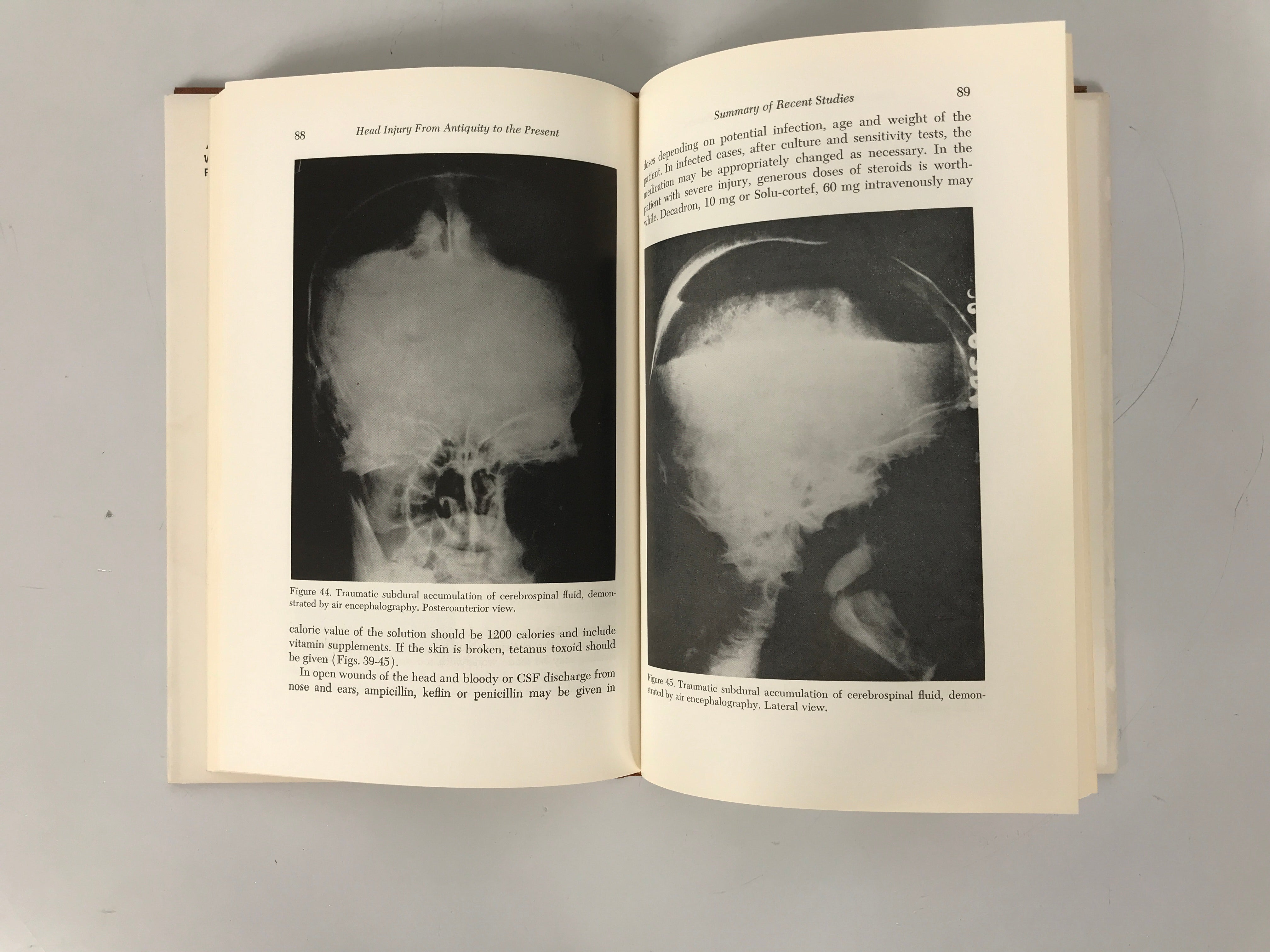 Lot of 2: Head Injury from Antiquity-Present/Head Wounds in WWII 1961-73 HC