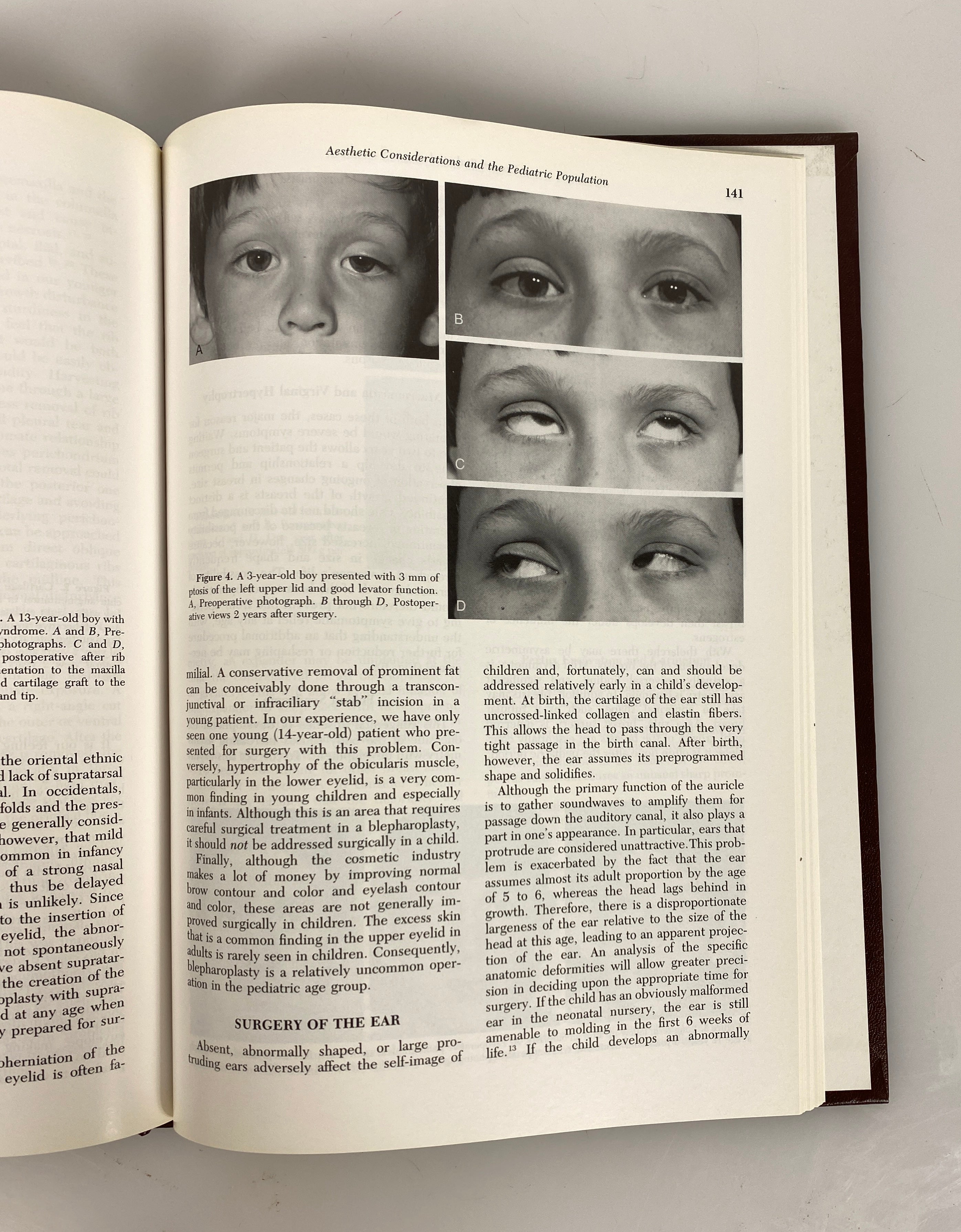 Lot of 31: Clinics in Plastic Surgery 1983-1995 W.B. Saunders Co. HC