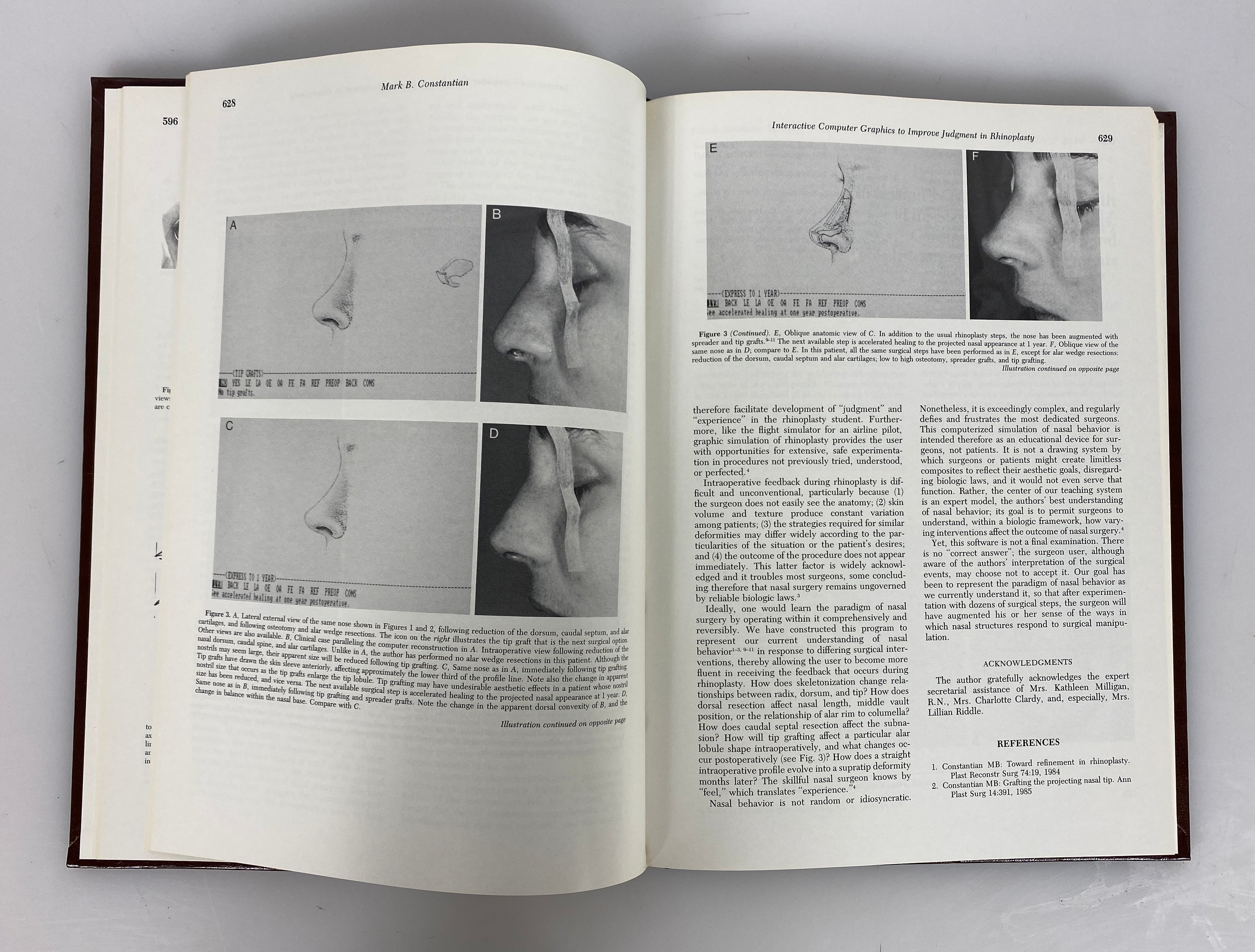 Lot of 31: Clinics in Plastic Surgery 1983-1995 W.B. Saunders Co. HC