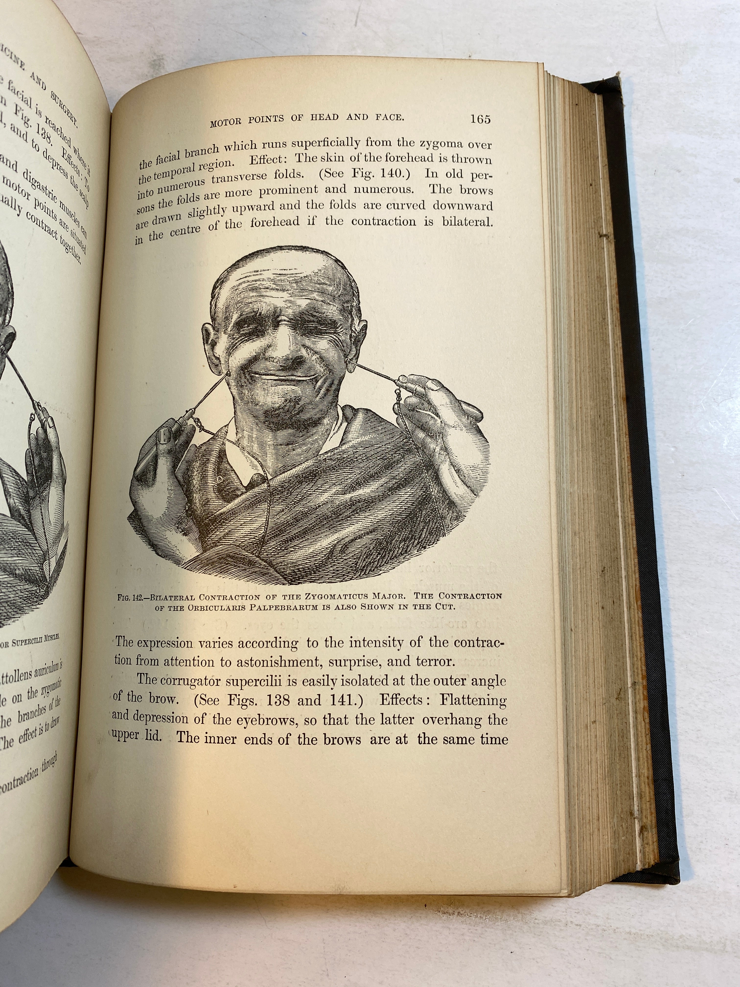 Practical Application of Electricity in Medicine and Surgery HC 1890