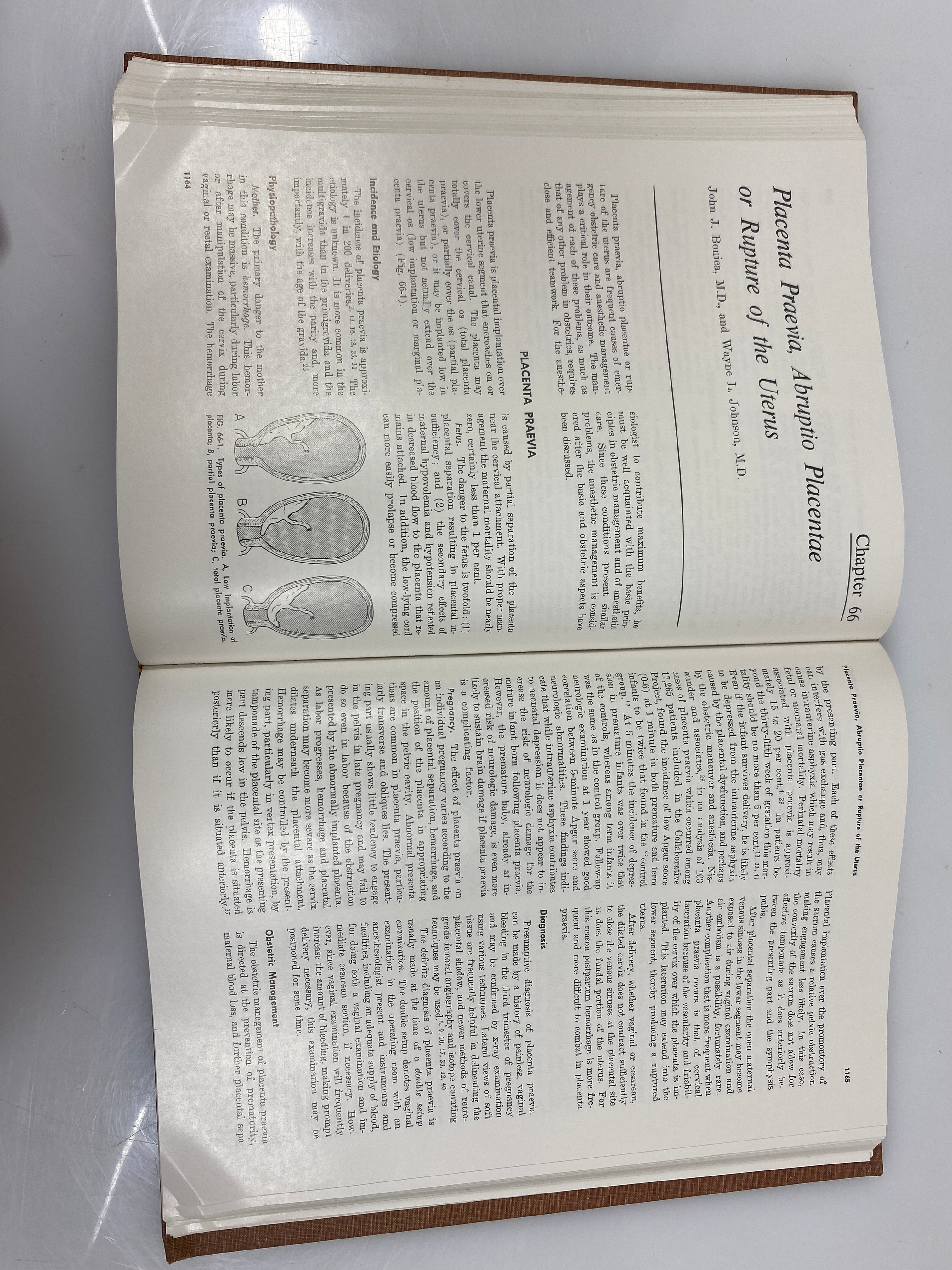 Principles and Practice of Obstetrics Analgesia & Anesthesia Vol. II 1969 HC